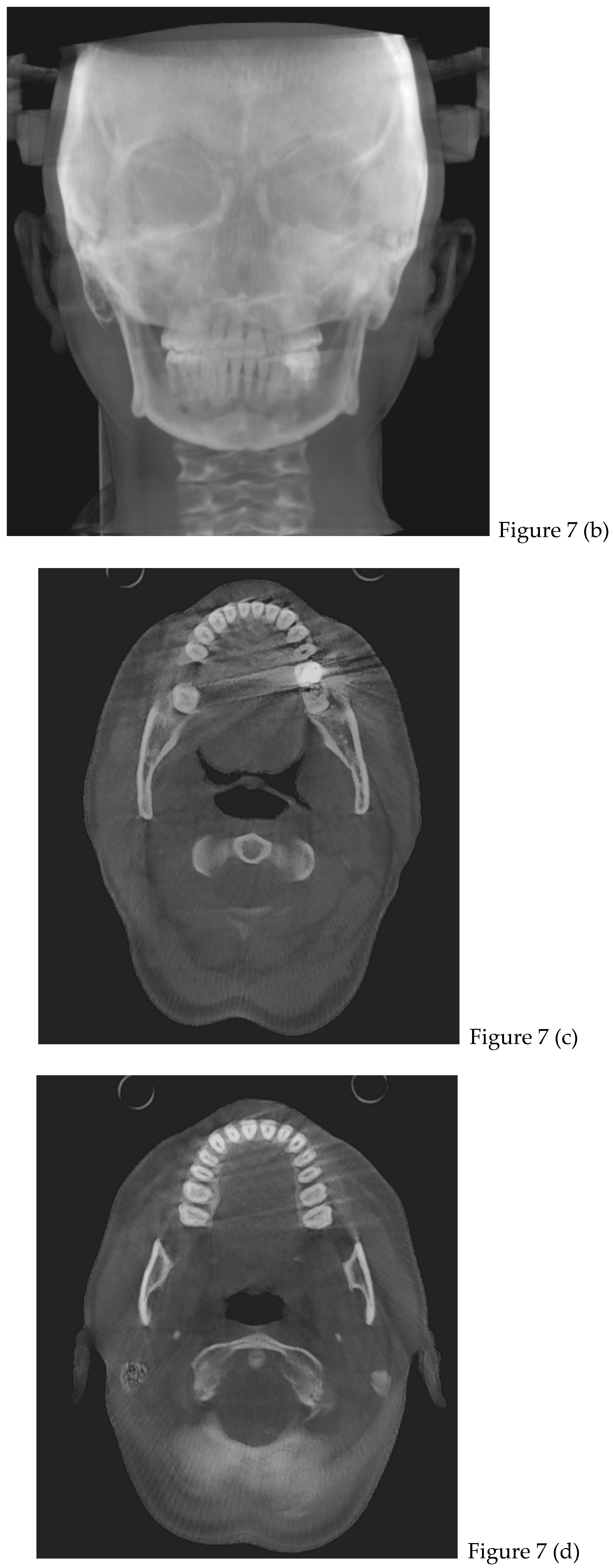 Preprints 168889 g007b