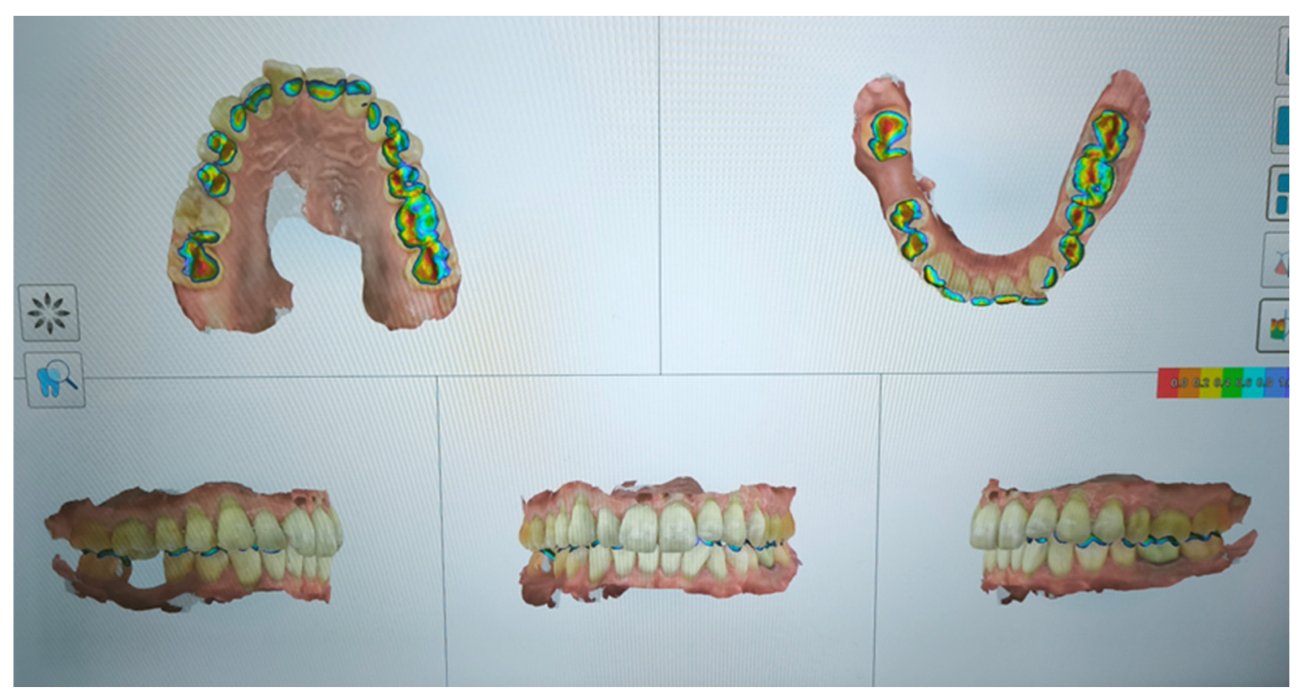 Preprints 168889 g008a
