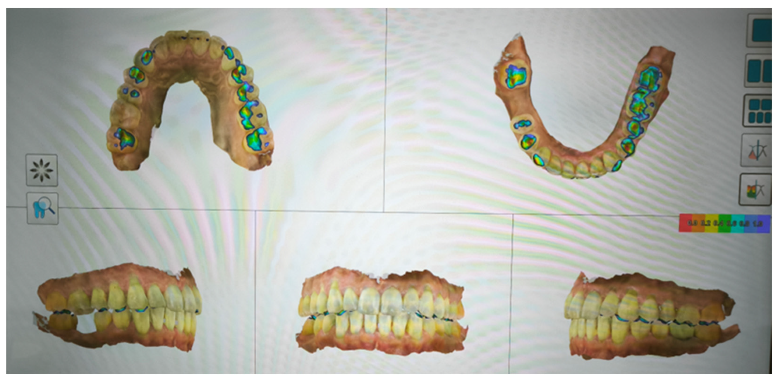 Preprints 168889 g008b