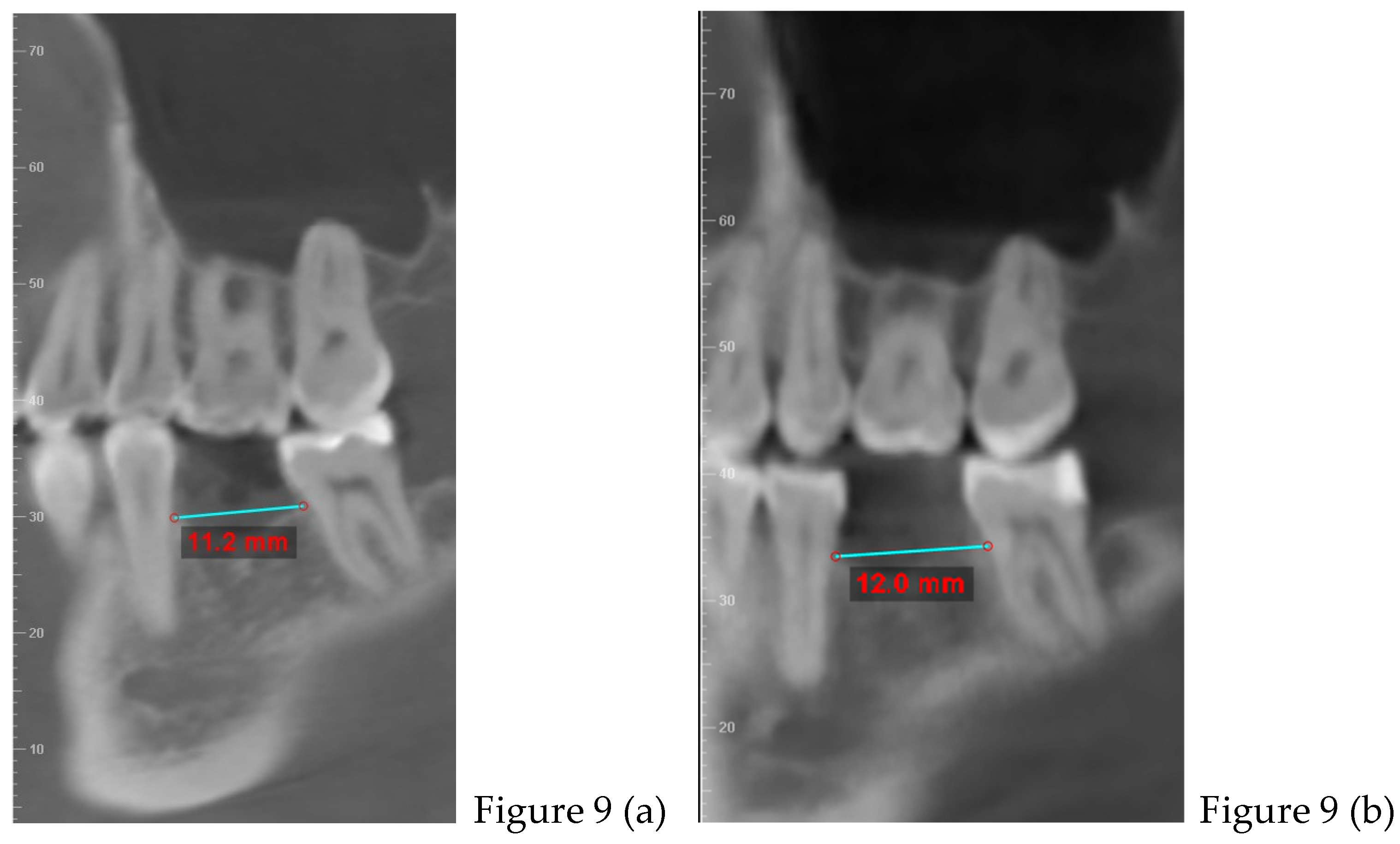 Preprints 168889 g009a