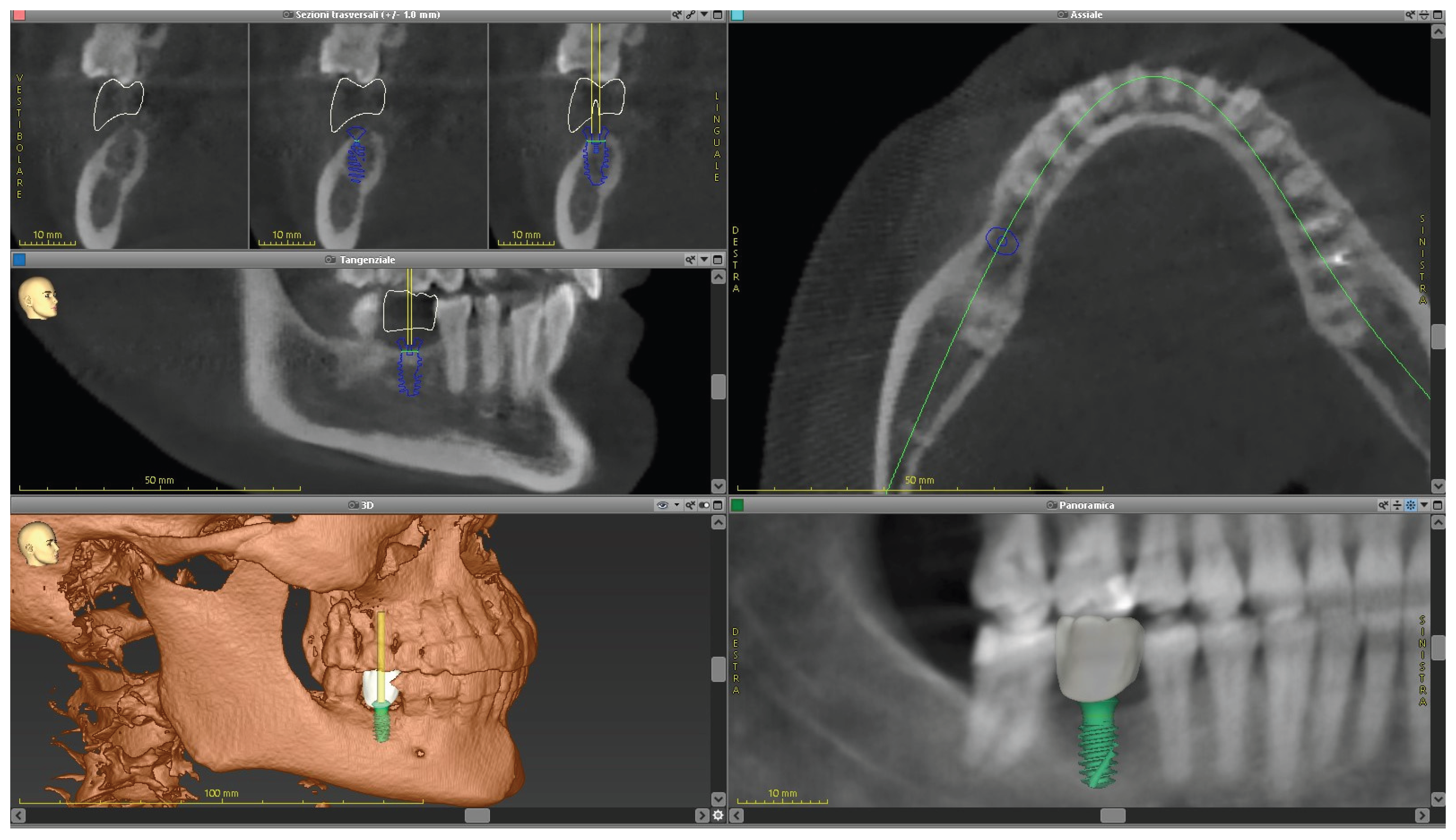 Preprints 168889 g009b