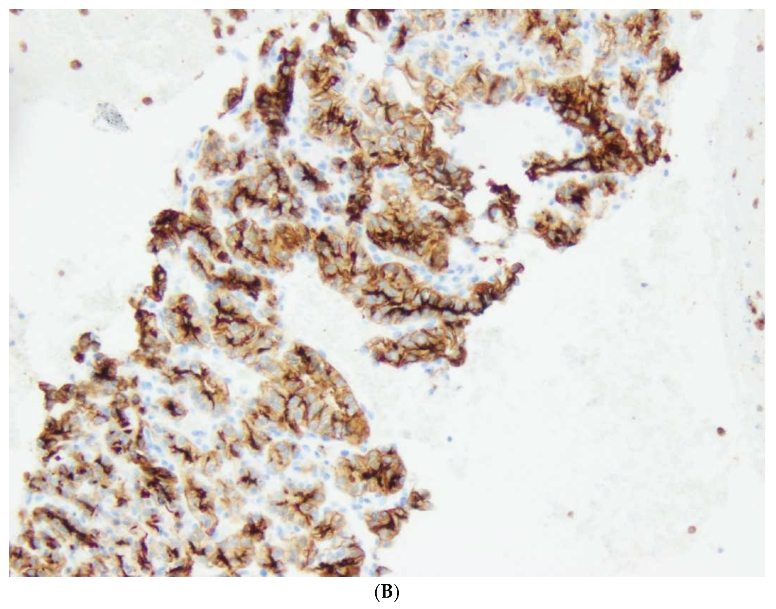 Preprints 166141 g005b