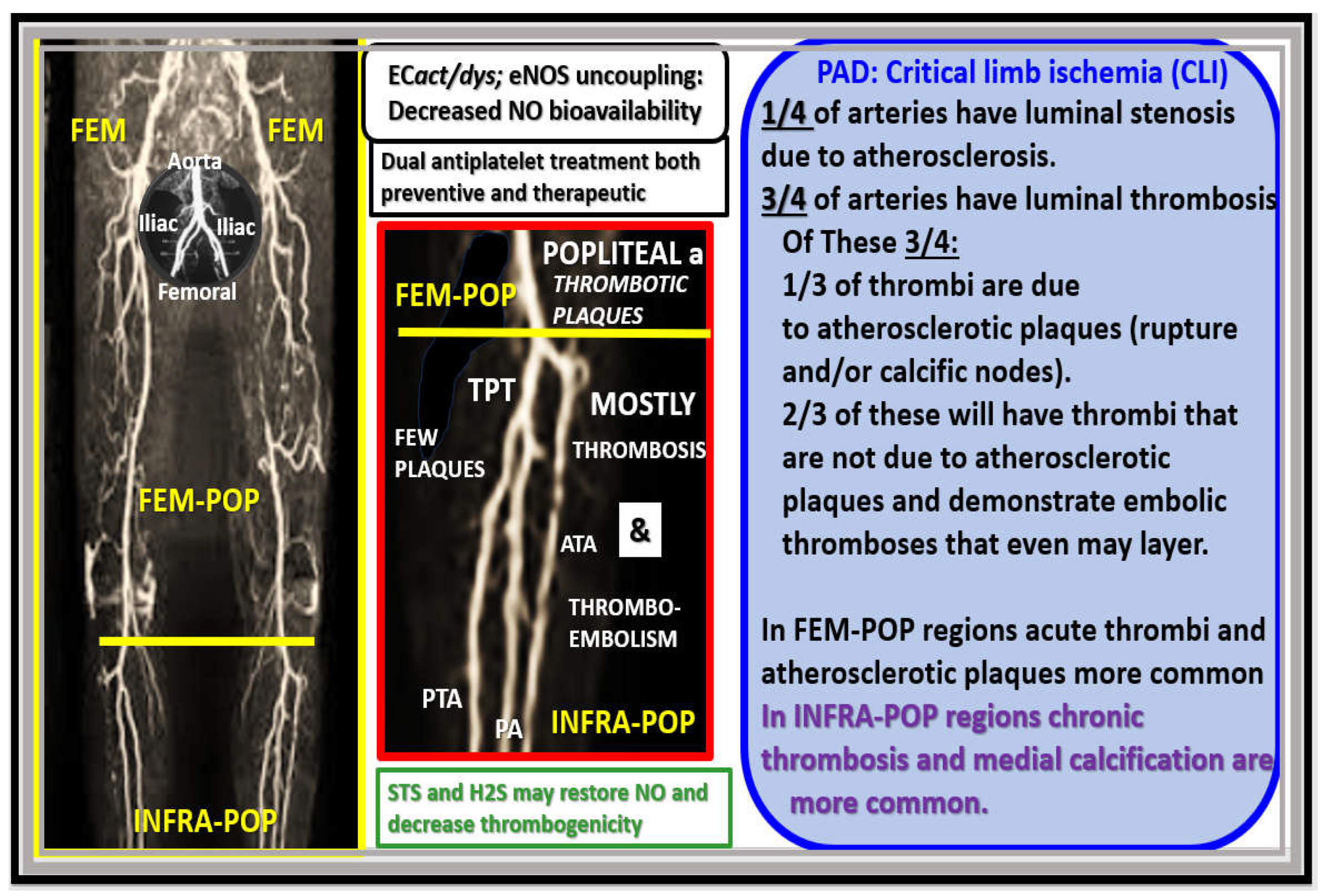 K-POP・アジア CD Funko Pop! Asia Monster Kappa Metallic Version Convention