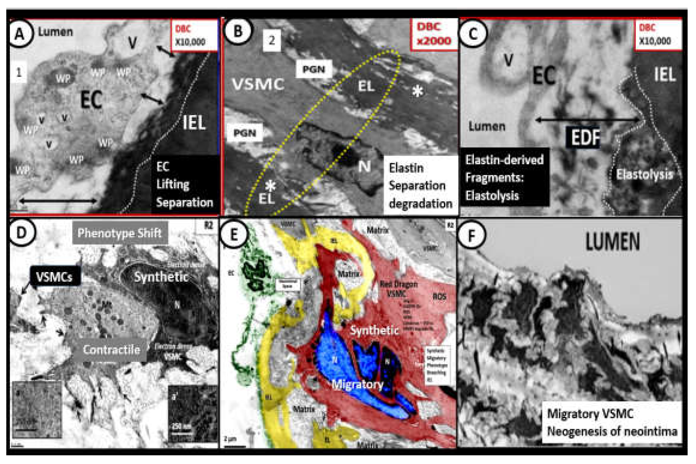 Preprints 156288 g014