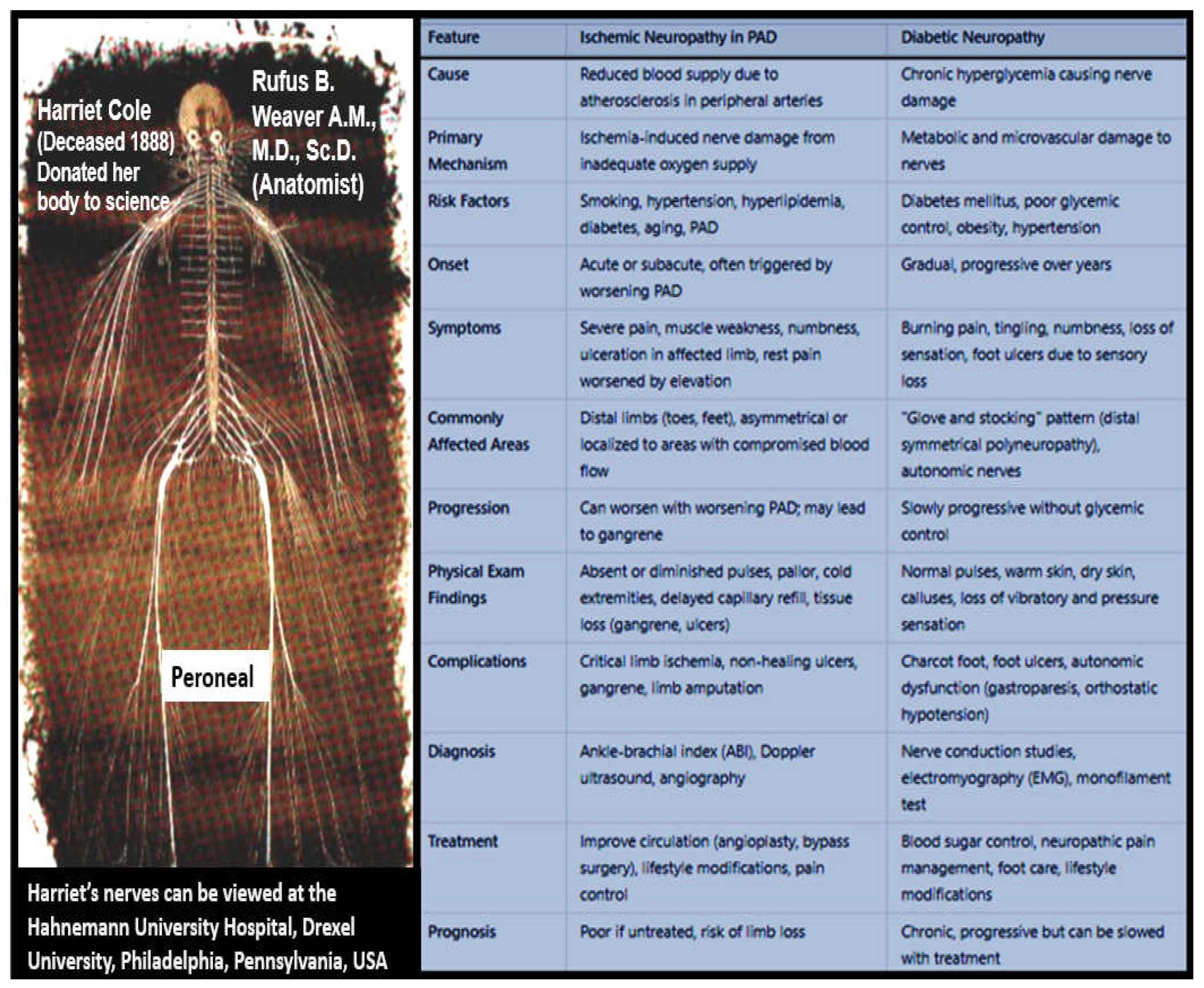 Lower Extremity Peripheral Artery Disease: Atherosclerosis