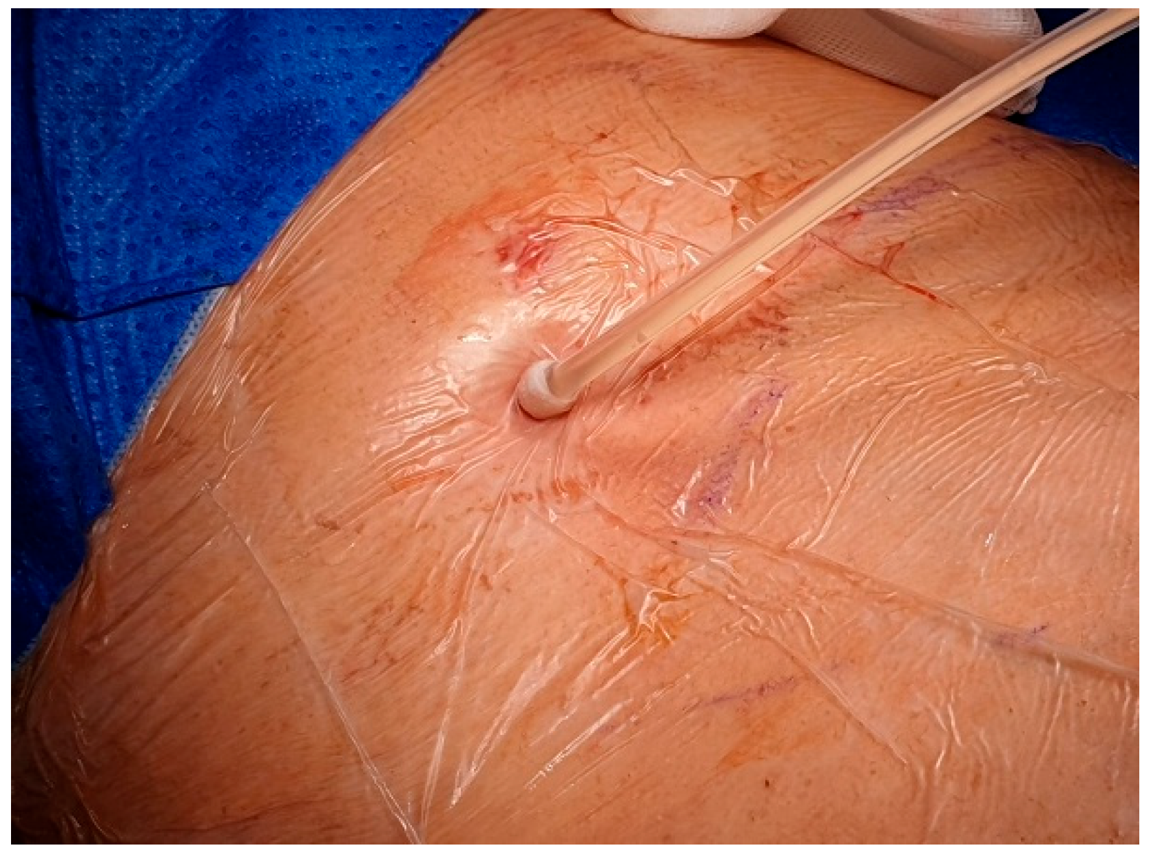 Preprints 180206 g003