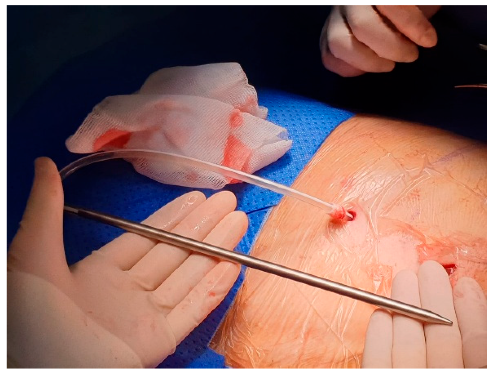 Preprints 180206 g004