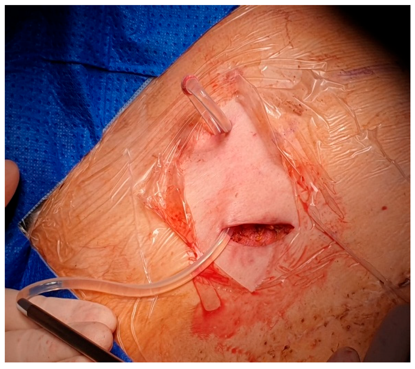 Preprints 180206 g005