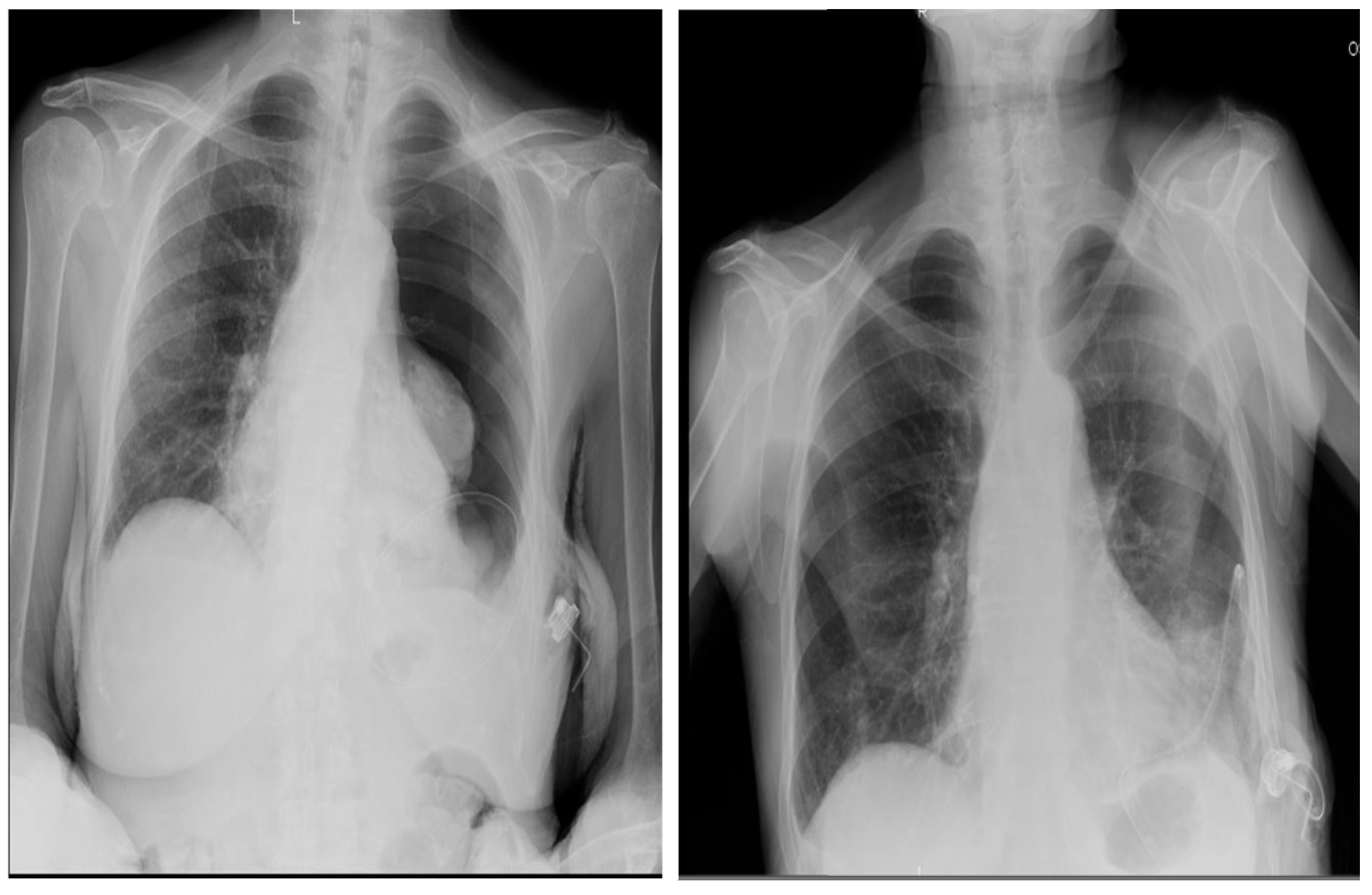 Preprints 180206 g008