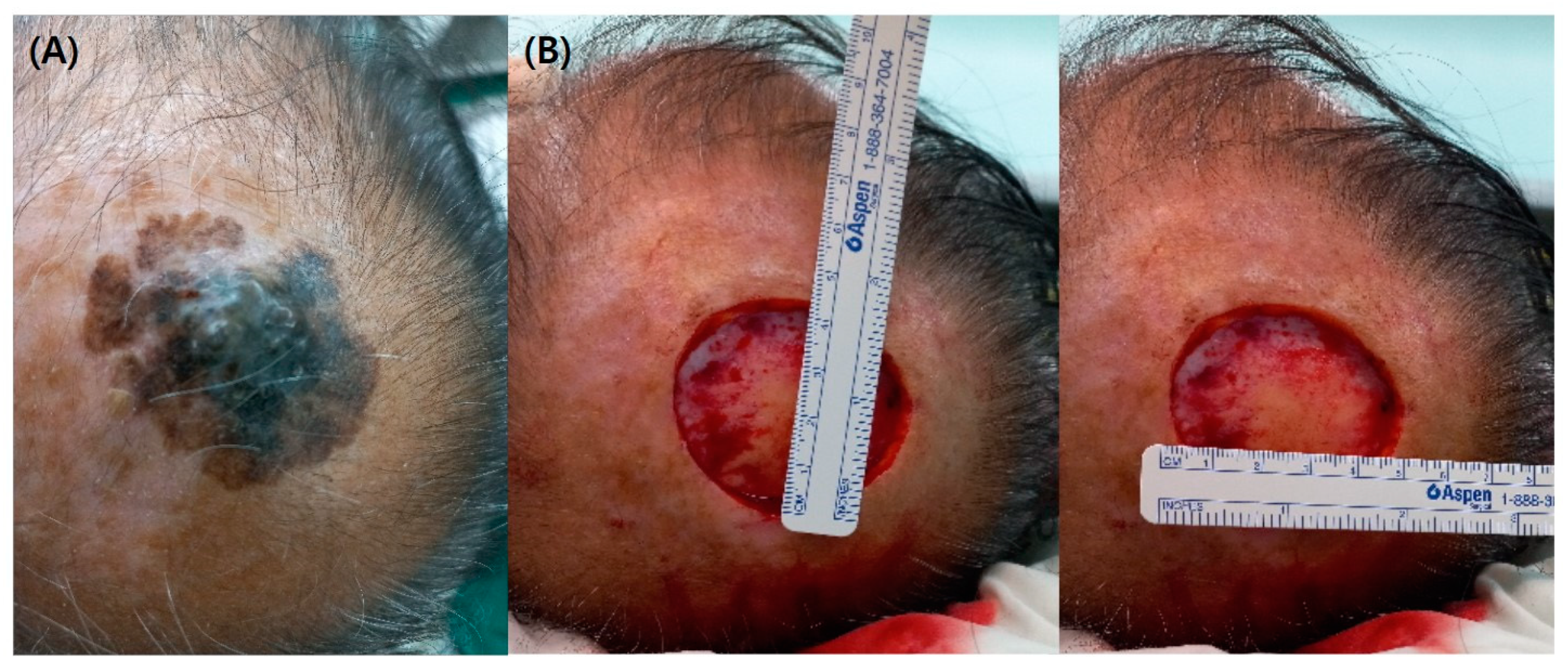 Preprints 86449 g001