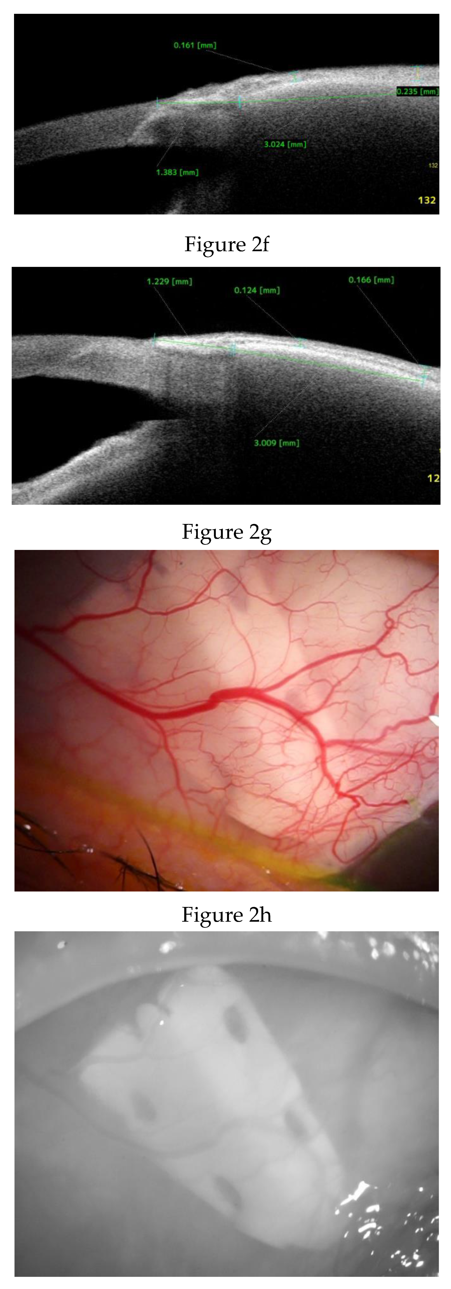 Preprints 175756 g002b