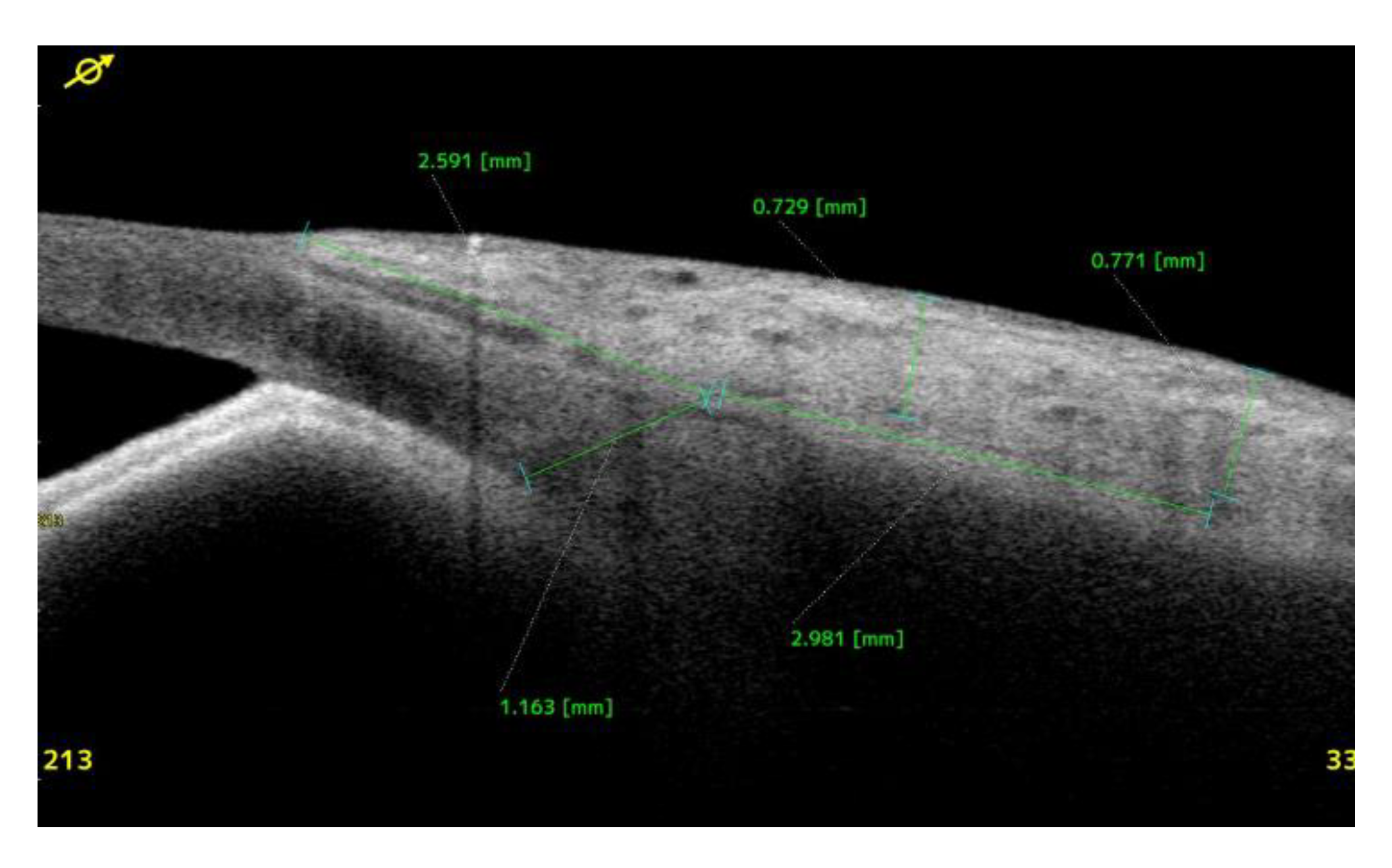 Preprints 175756 g004b