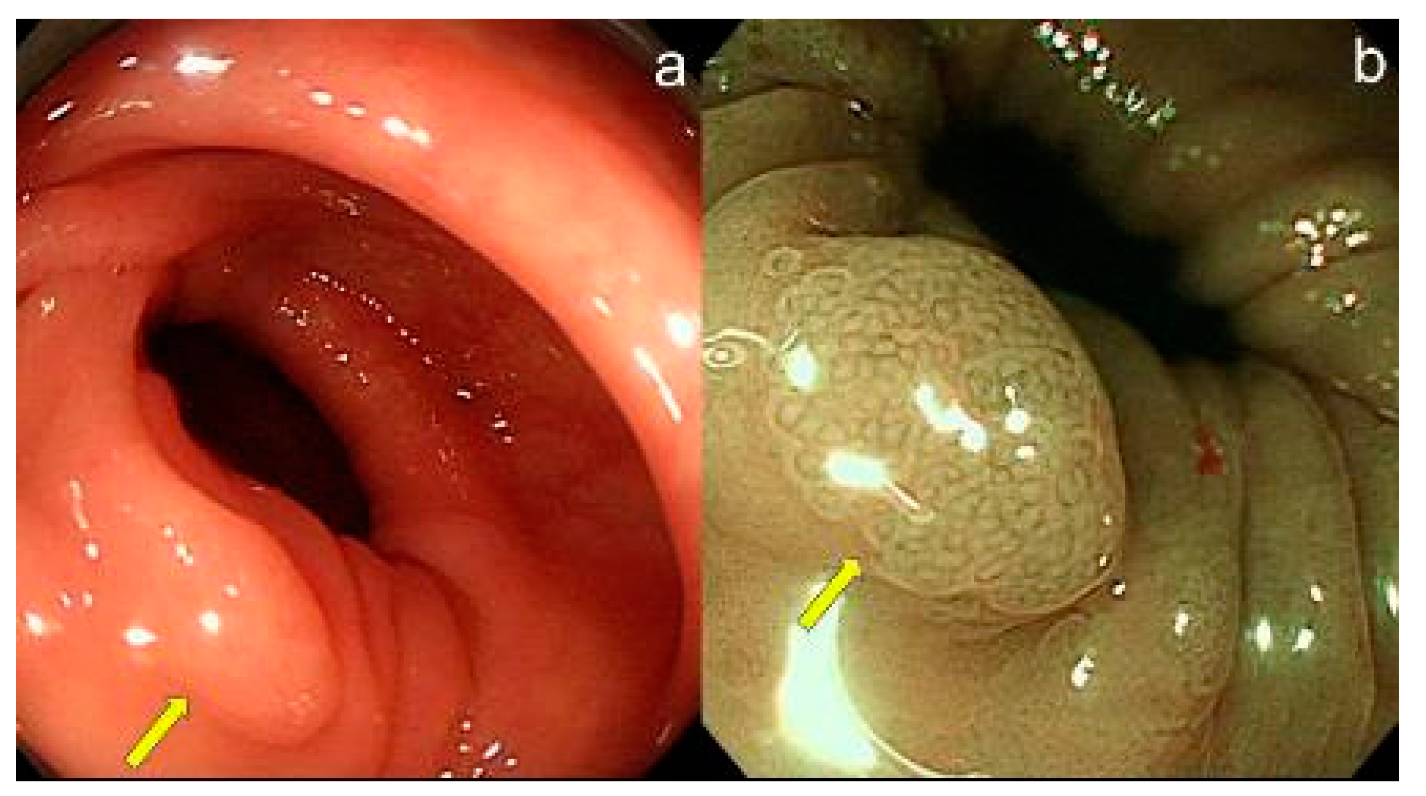 Preprints 100171 g001