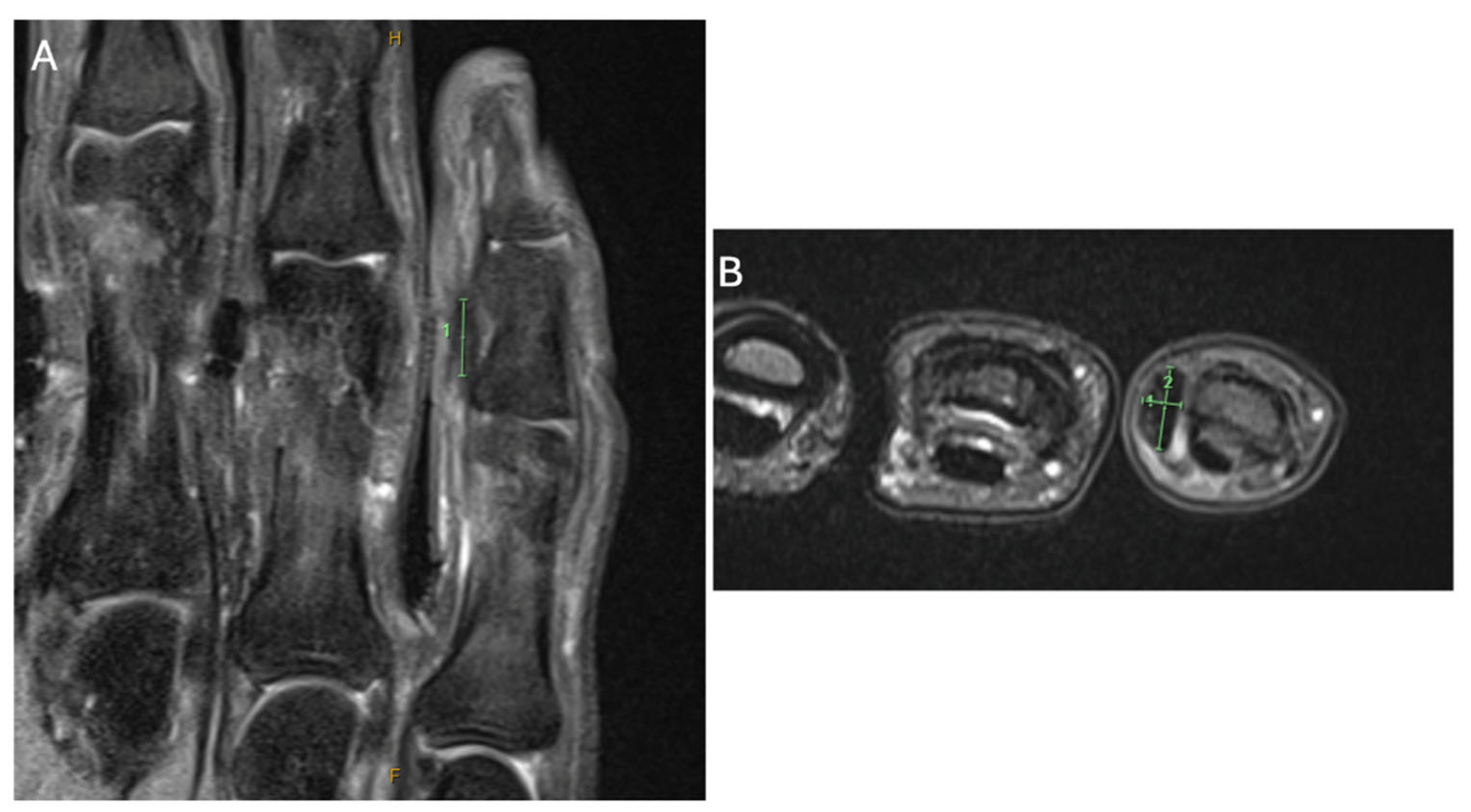 Preprints 200603 g002