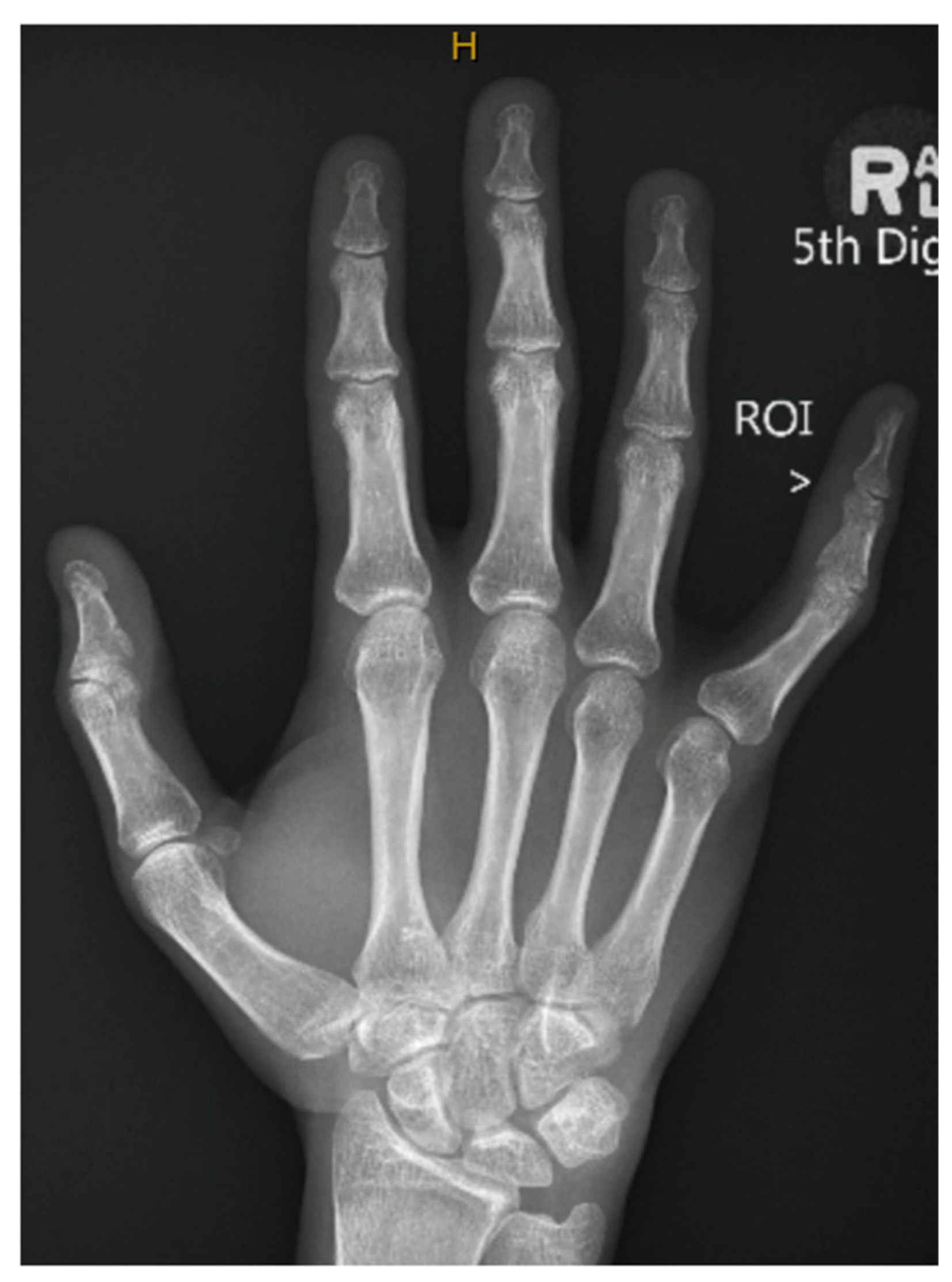 Preprints 200603 g003