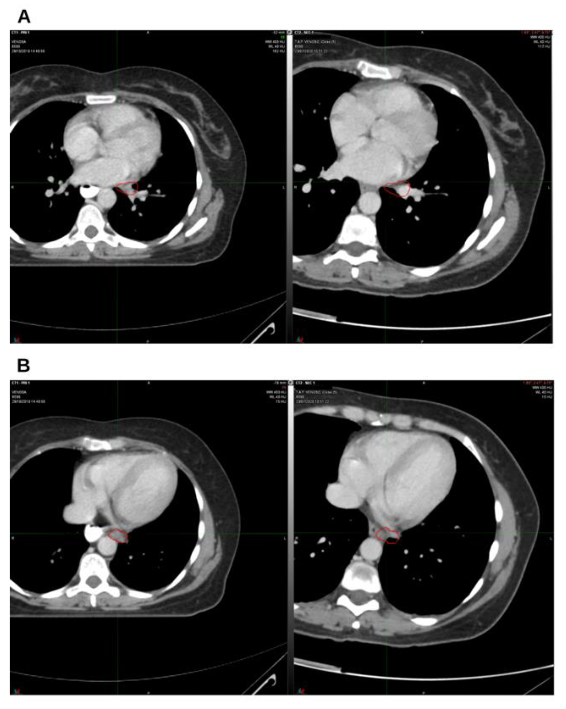 Preprints 184656 g004