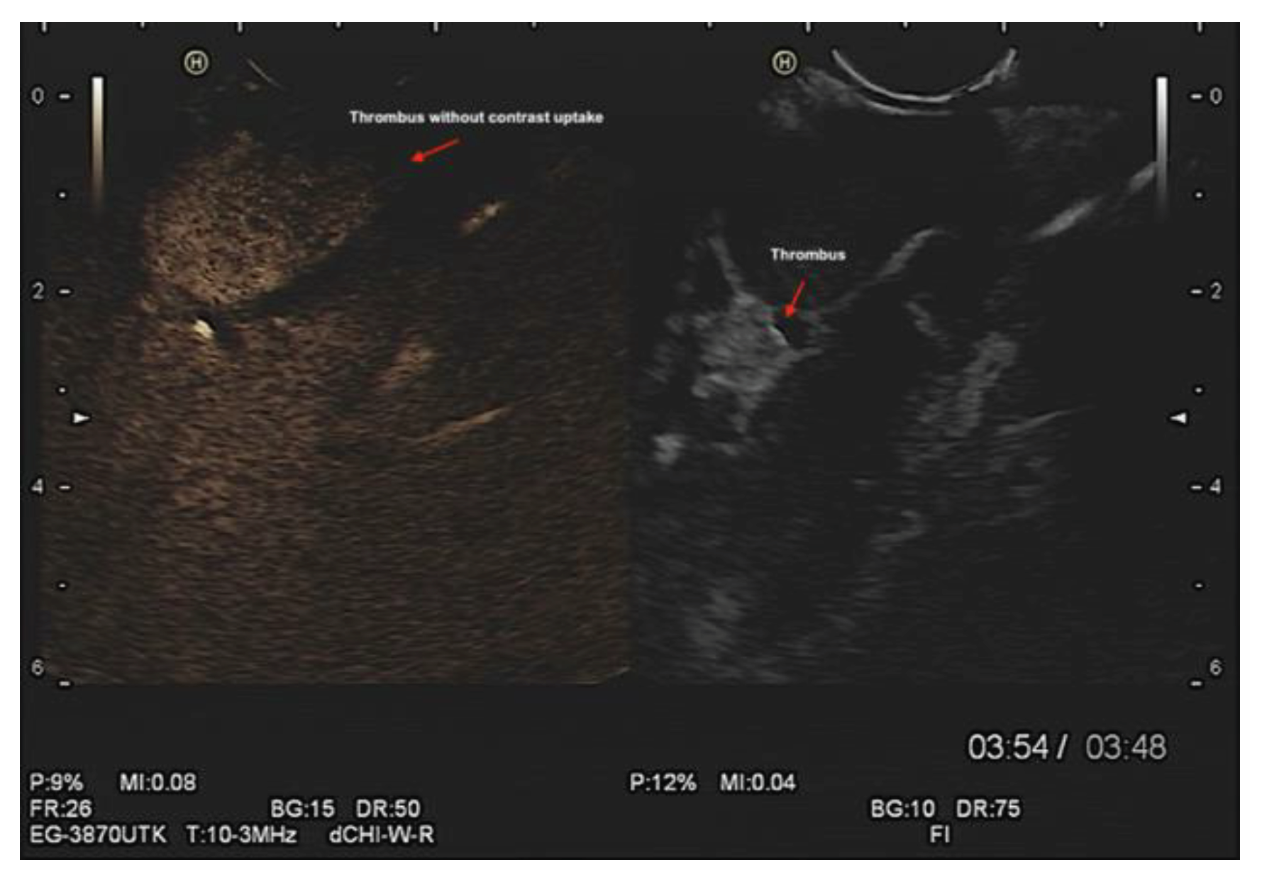 Preprints 79537 g006