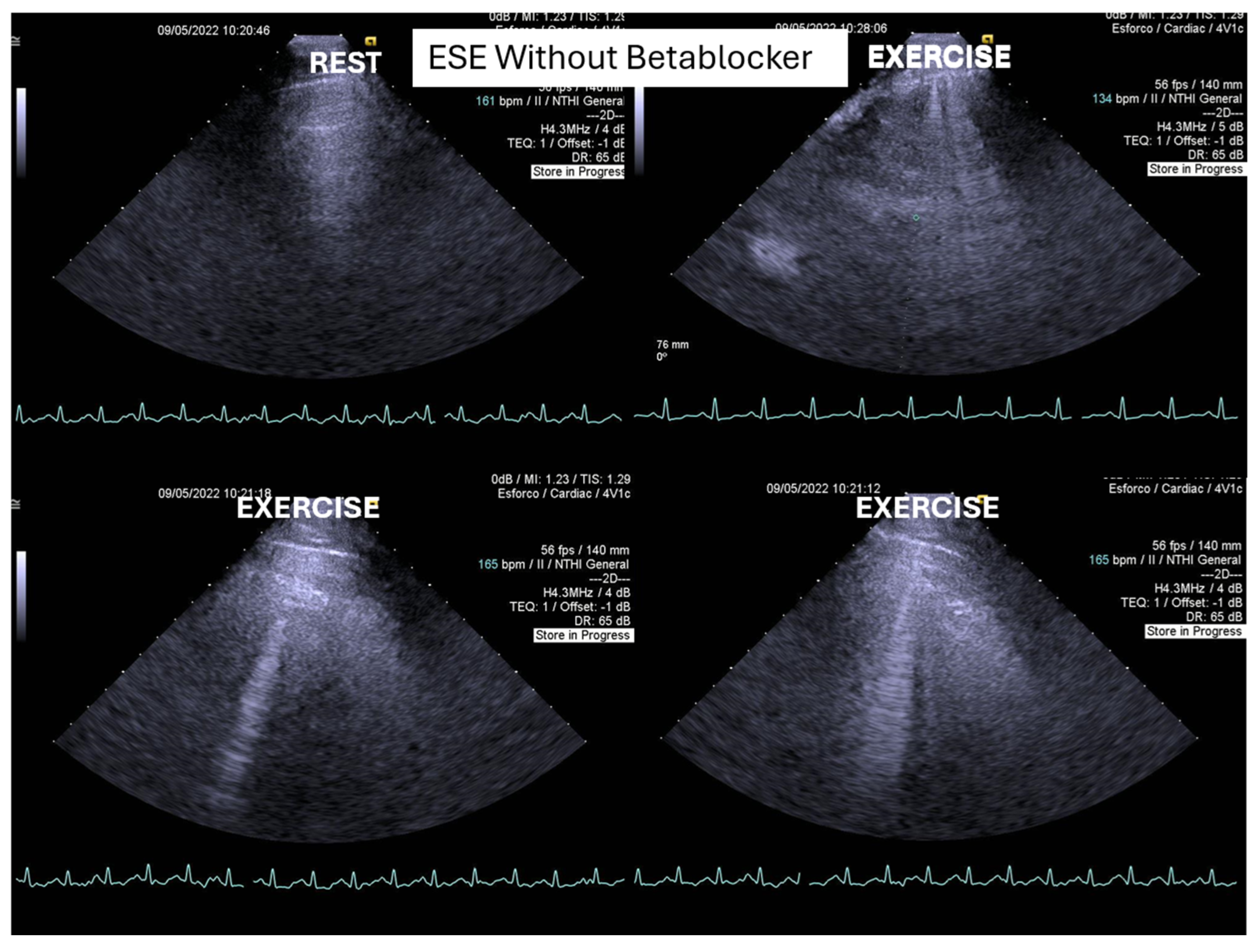 Preprints 160979 g003