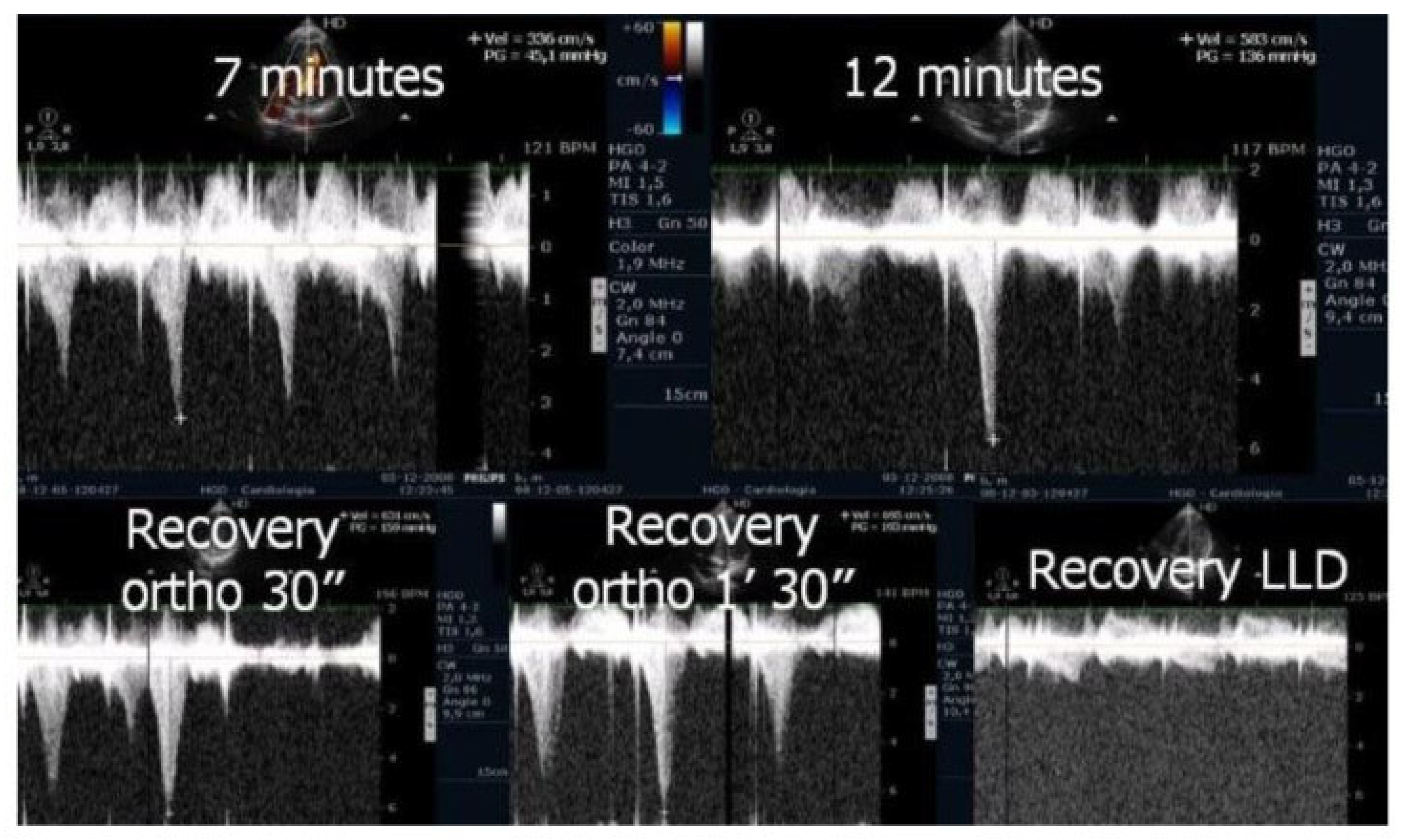 Preprints 160979 g006