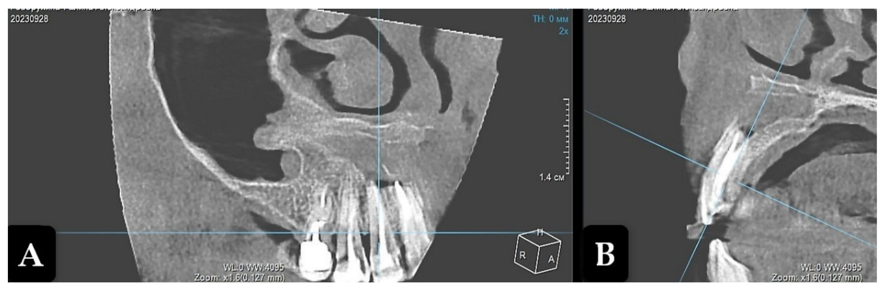 Preprints 159972 g004
