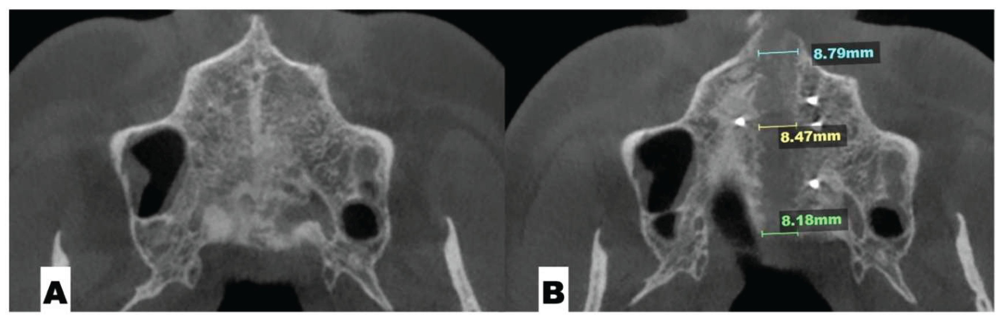 Preprints 175625 g002