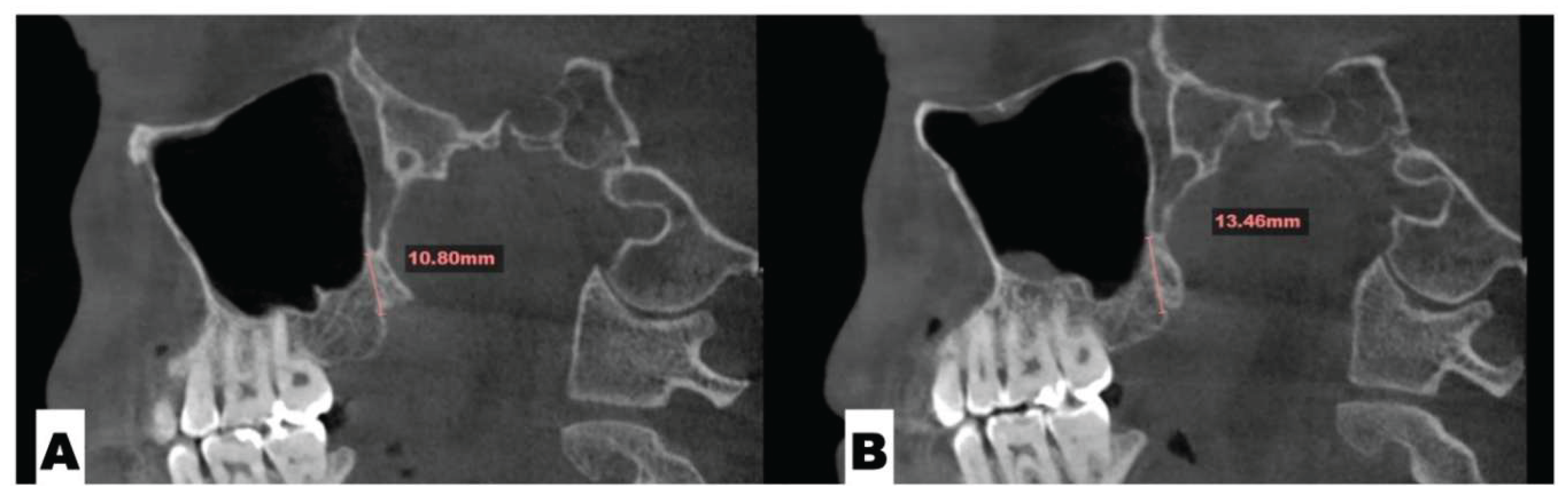 Preprints 175625 g004