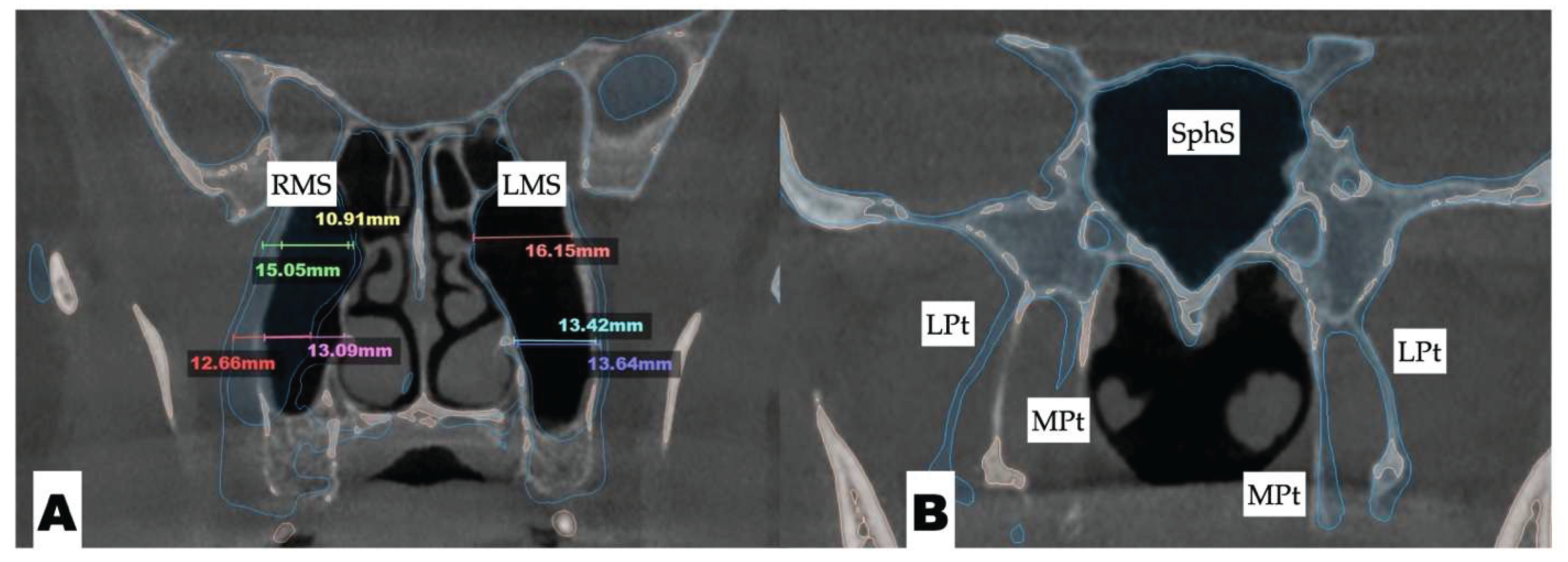 Preprints 175625 g011