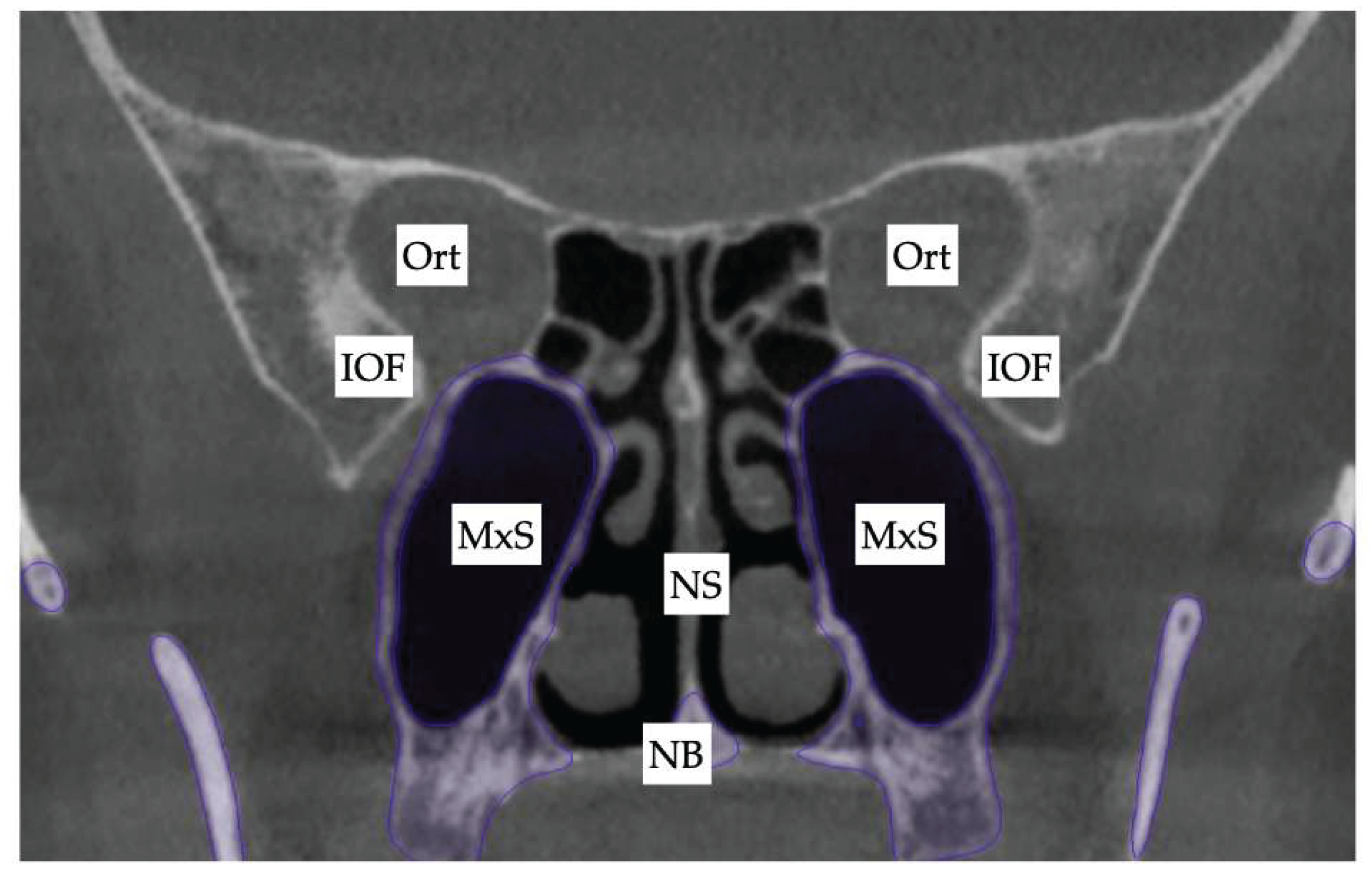Preprints 175625 g012