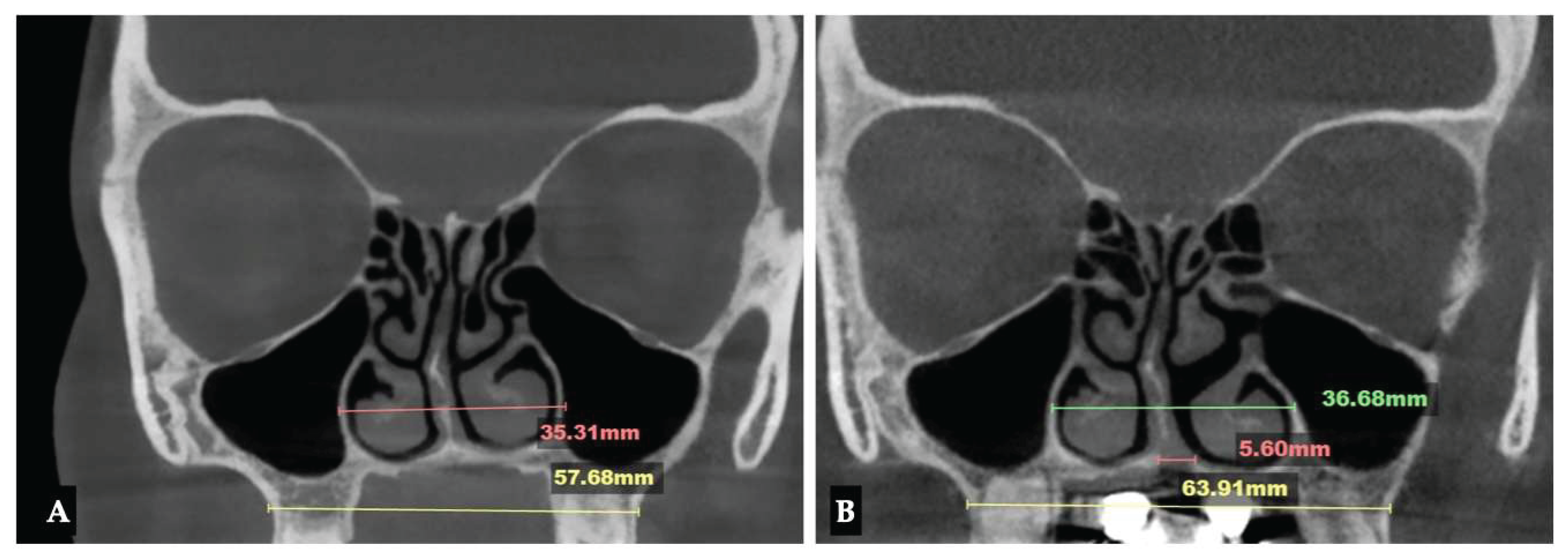 Preprints 175625 g023