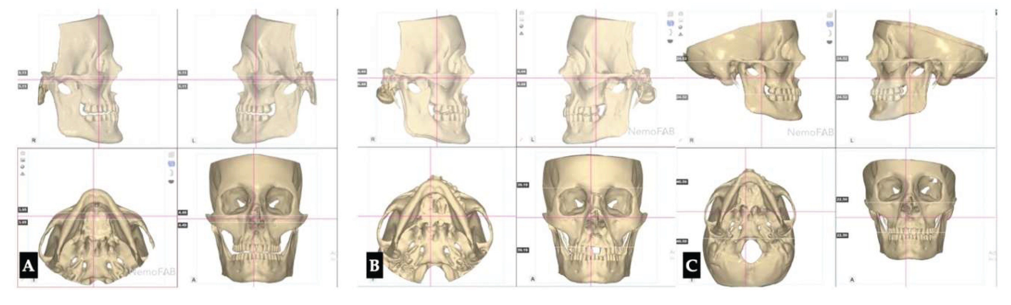 Preprints 175625 g028