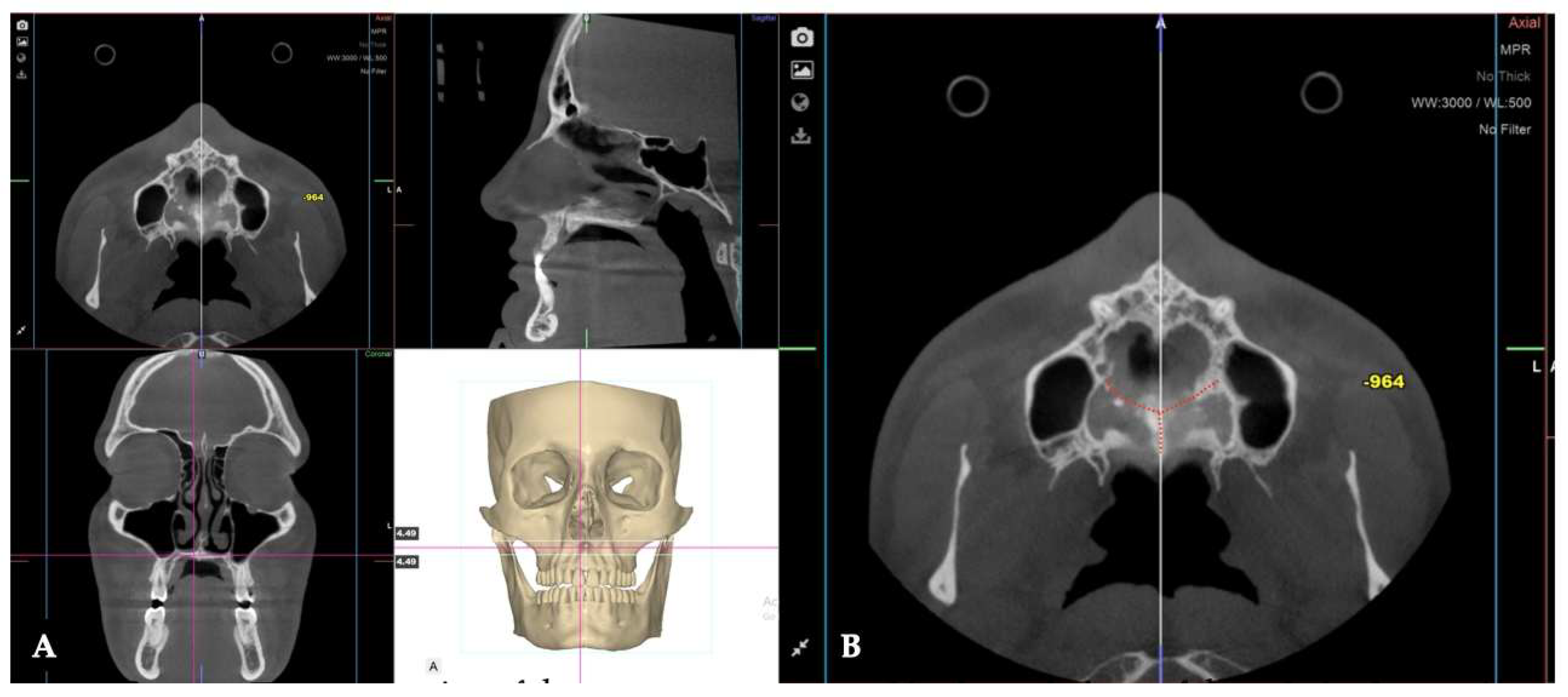 Preprints 175625 g029