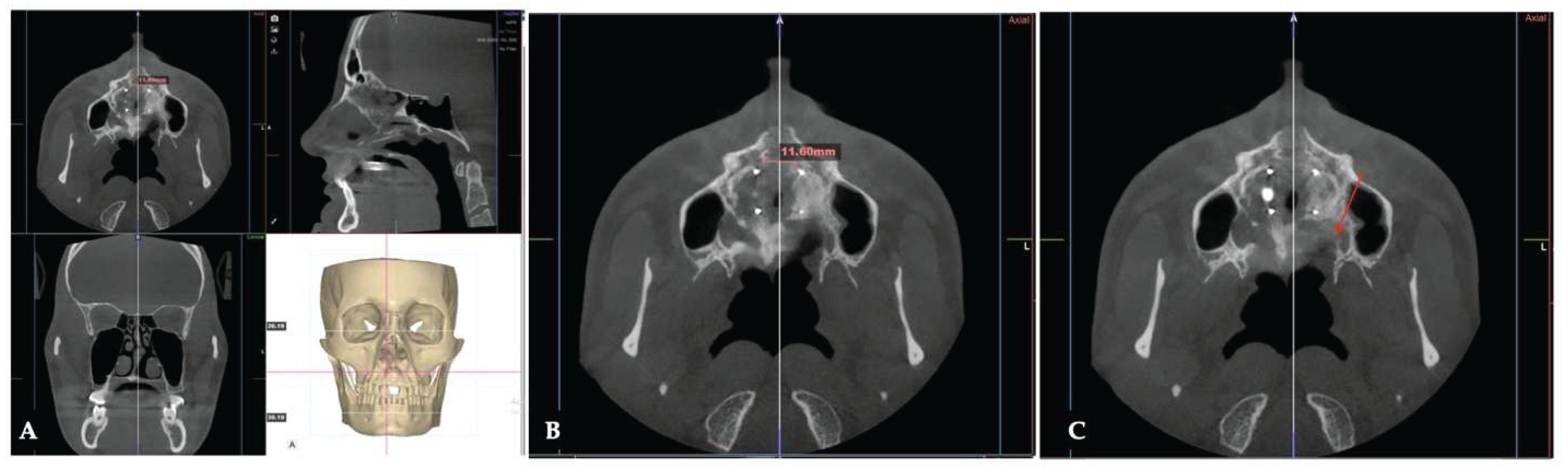 Preprints 175625 g030