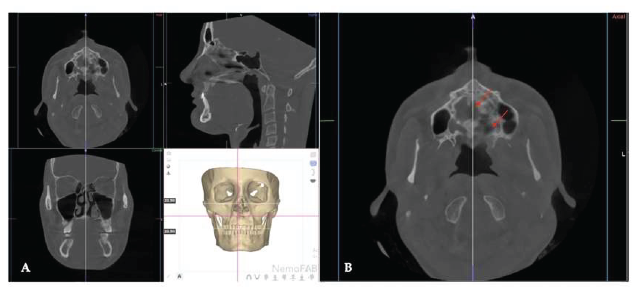 Preprints 175625 g031