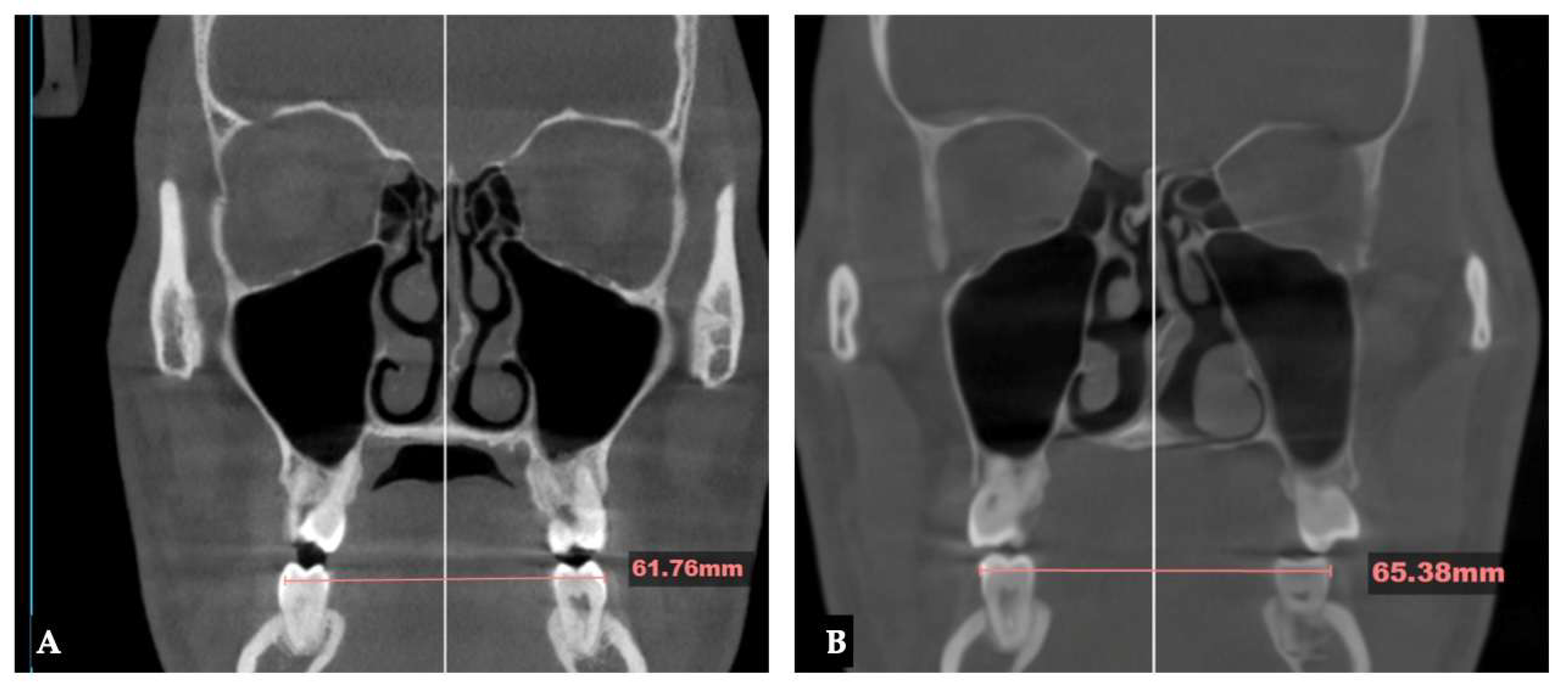Preprints 175625 g032