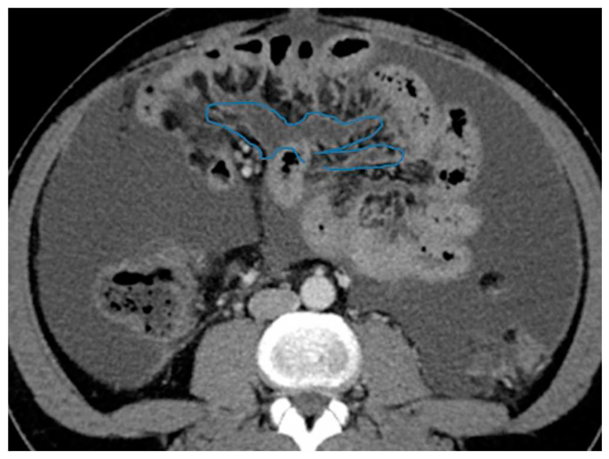 Preprints 73100 g025