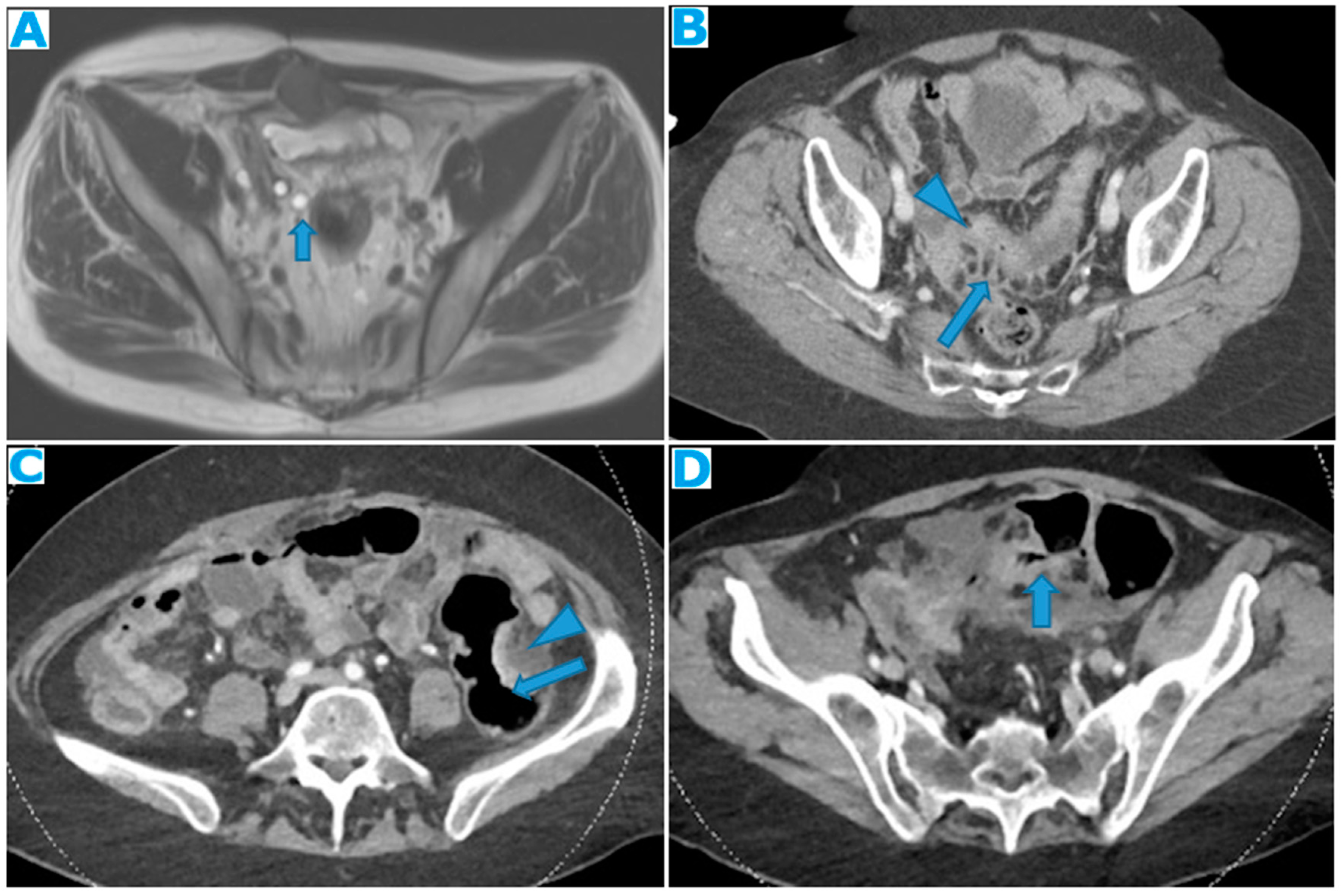 Preprints 73100 g031
