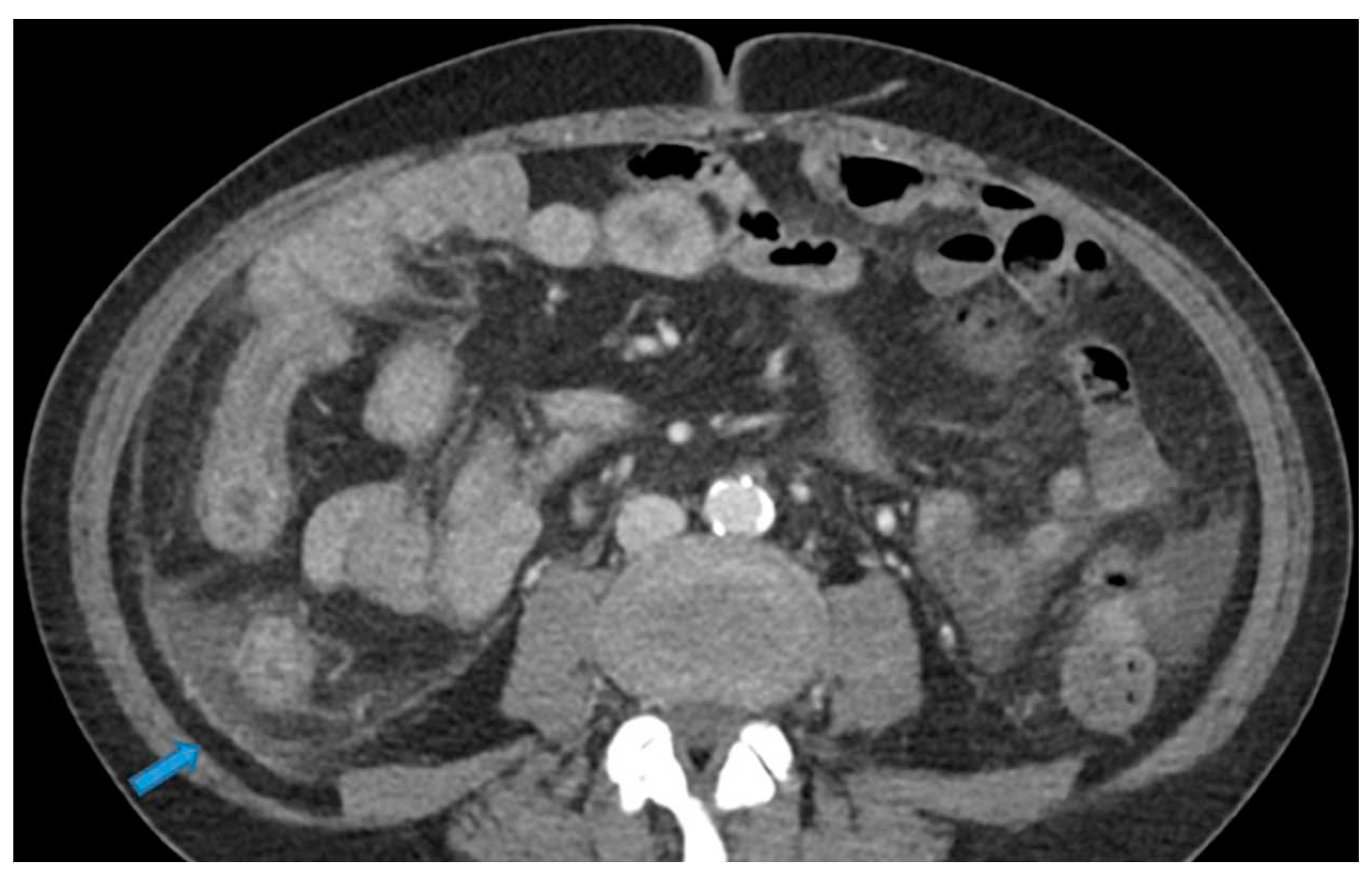 Preprints 73100 g040