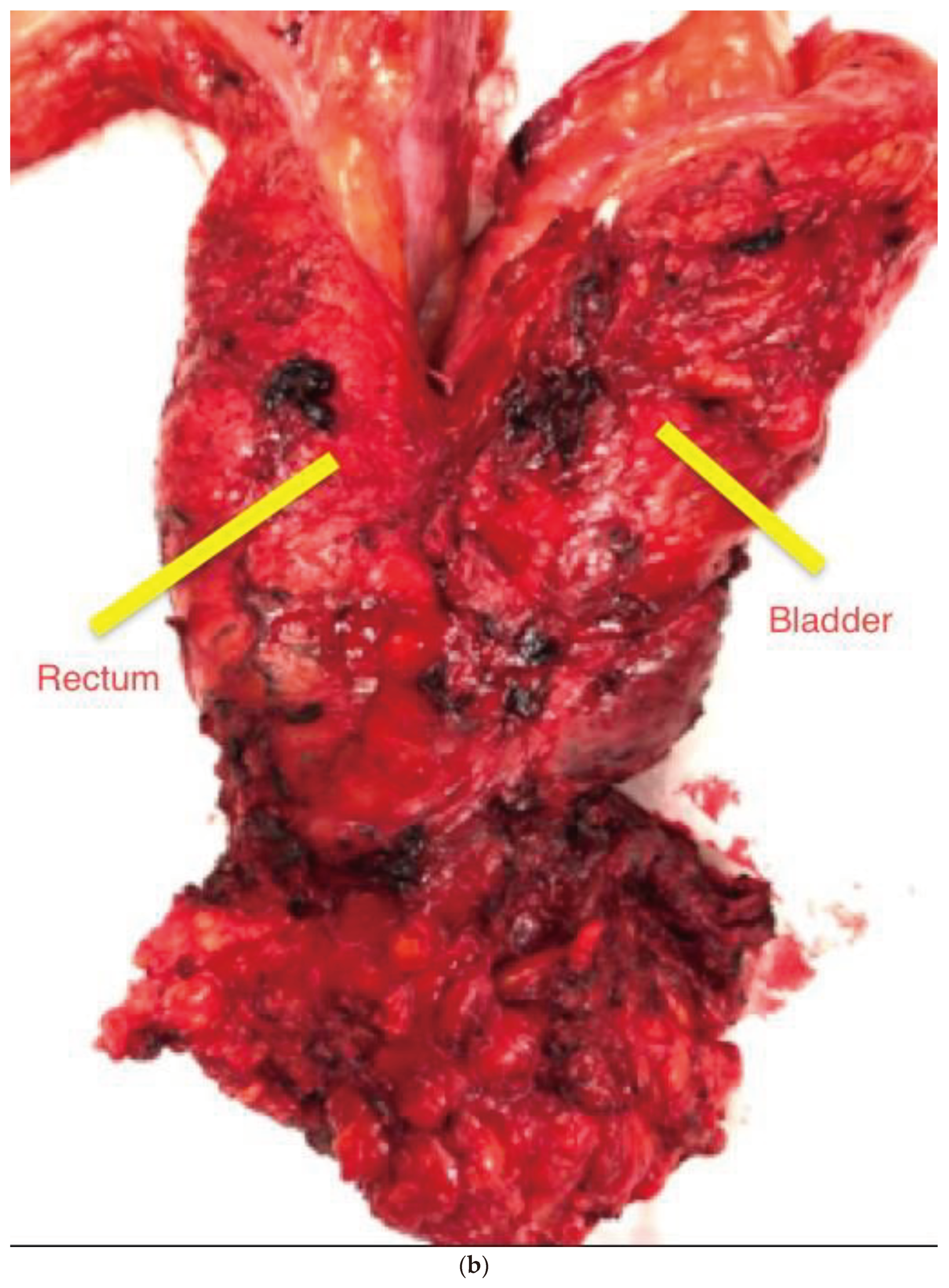 Preprints 101807 g002b