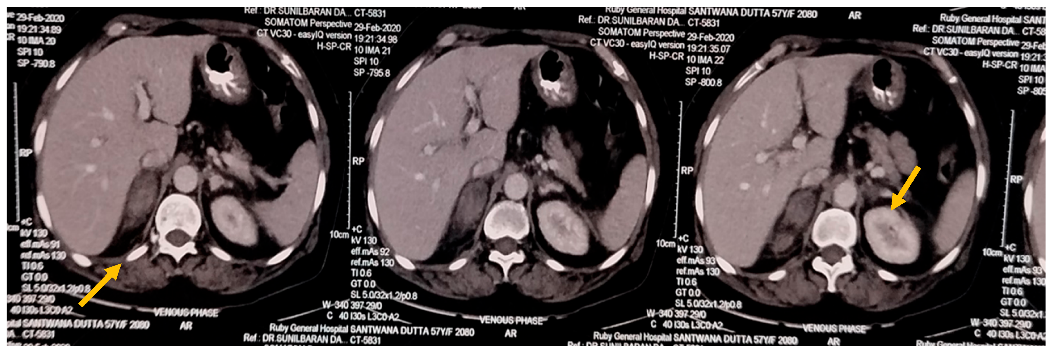 Preprints 154341 g001