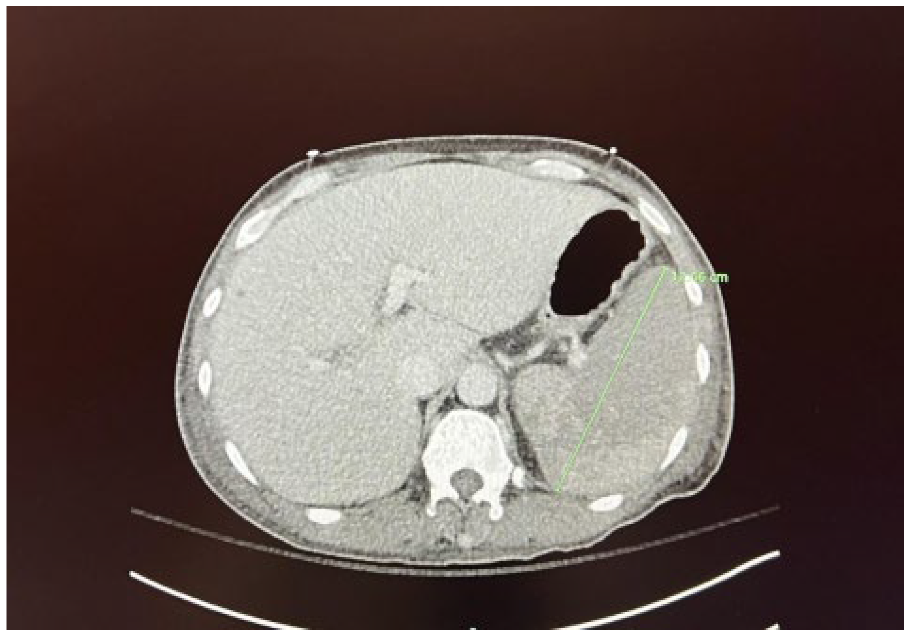 Preprints 138637 g001