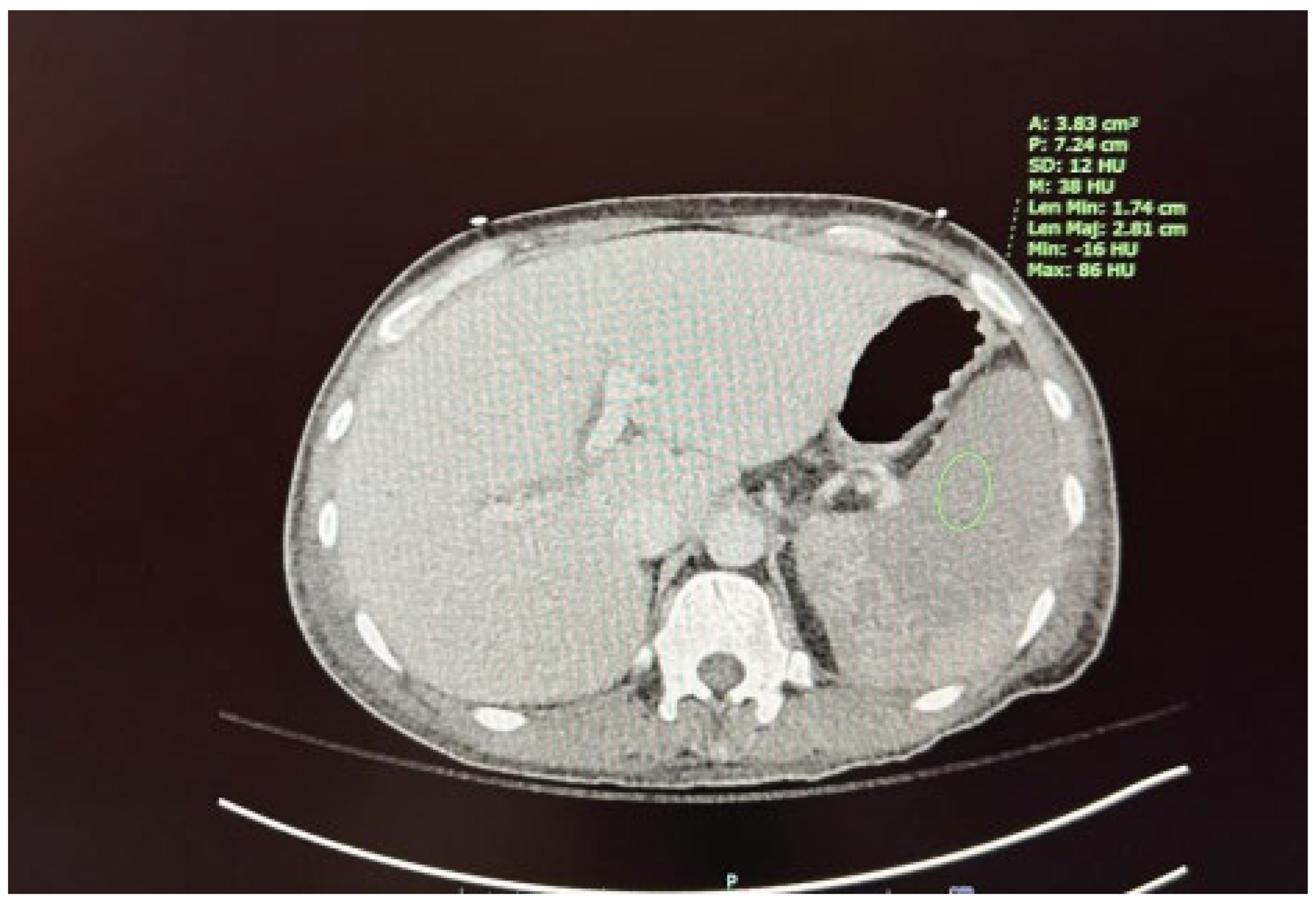 Preprints 138637 g002