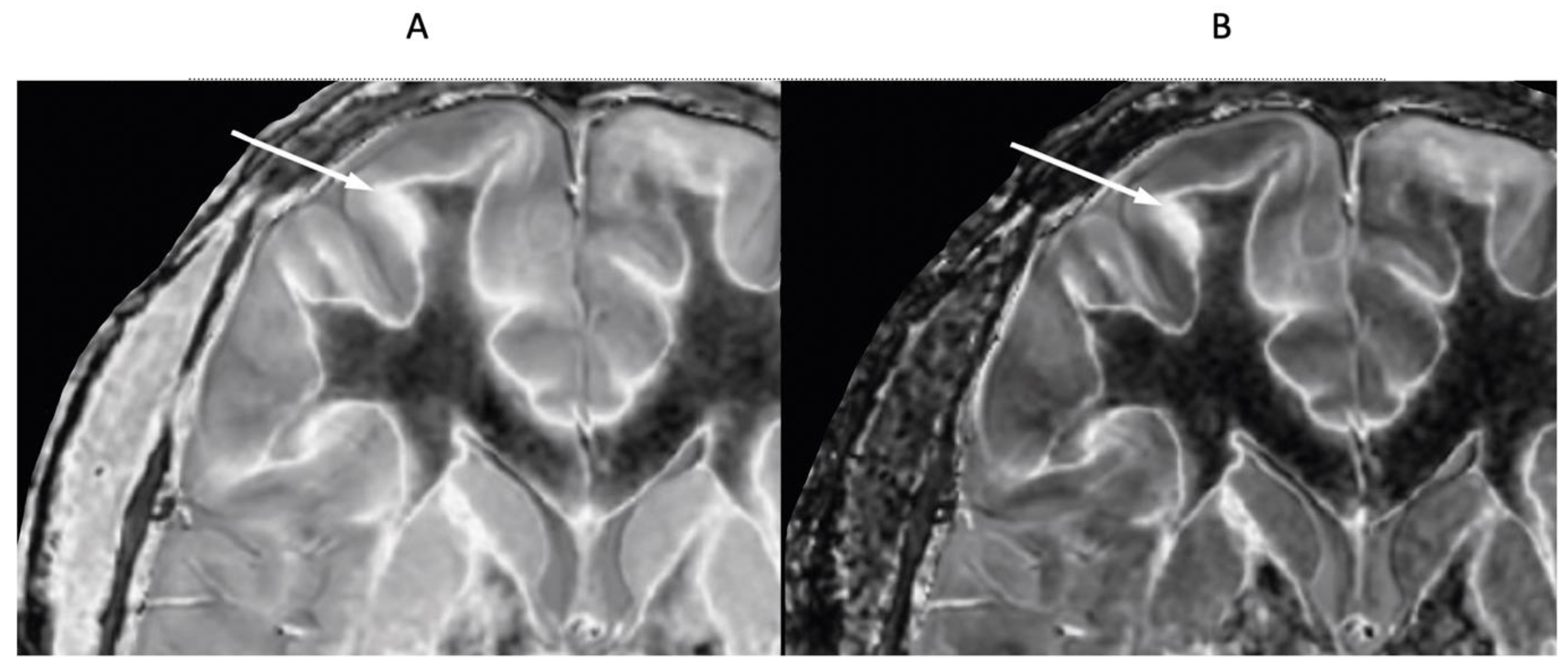 Preprints 162895 g017