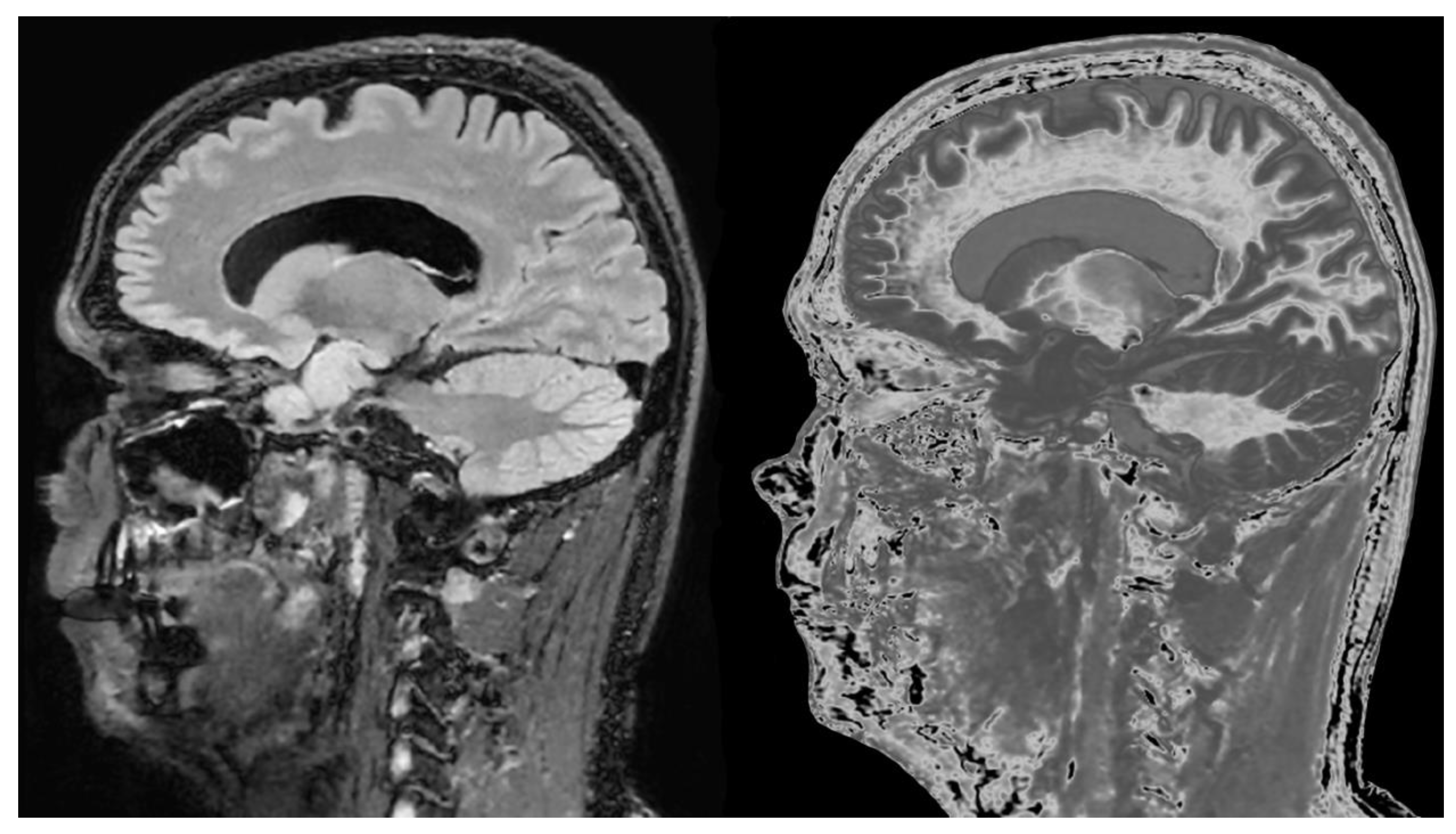 Preprints 162895 g021