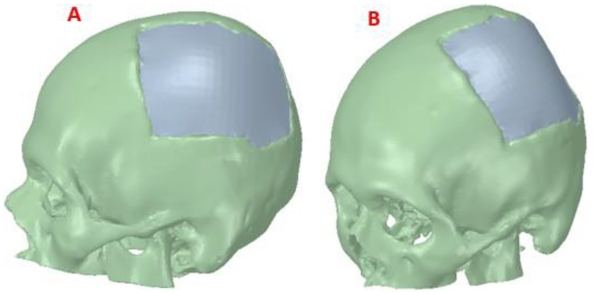 Preprints 79867 g004