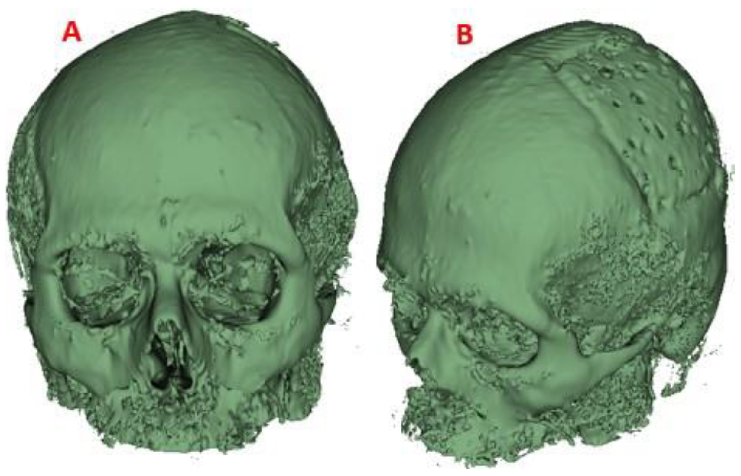 Preprints 79867 g014