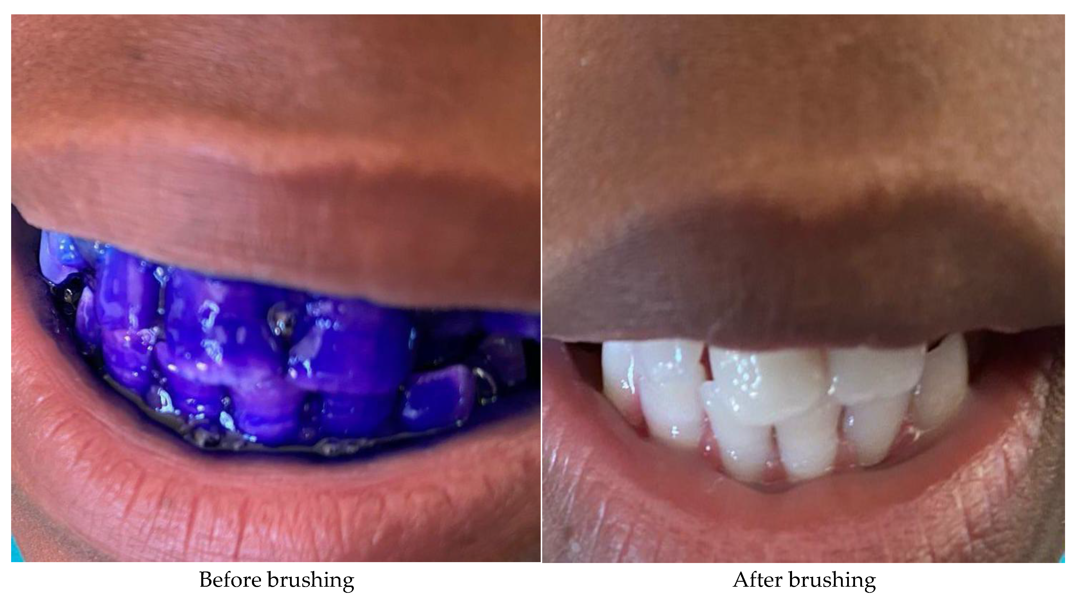 Preprints 176799 g003