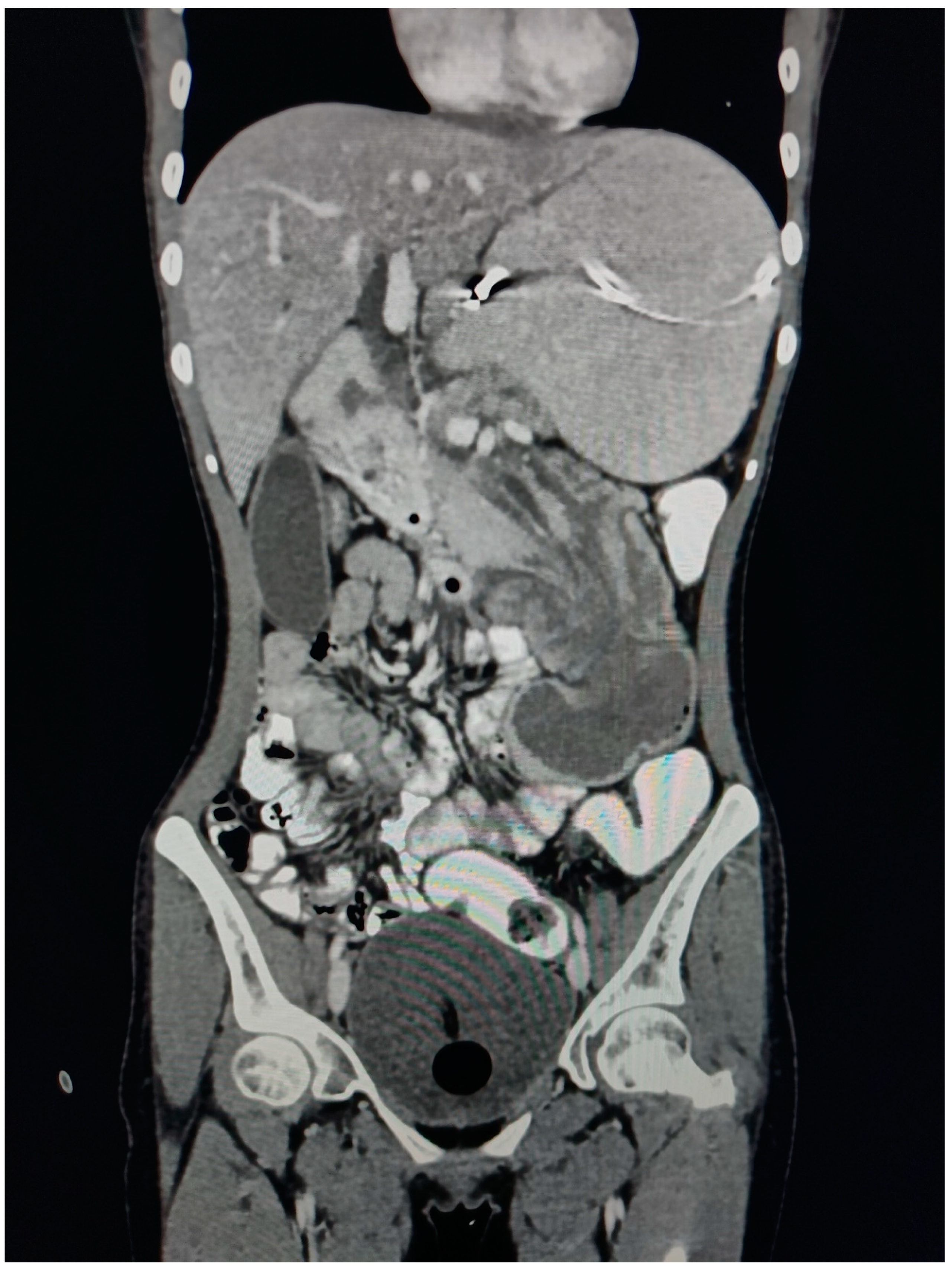 Preprints 89586 g003