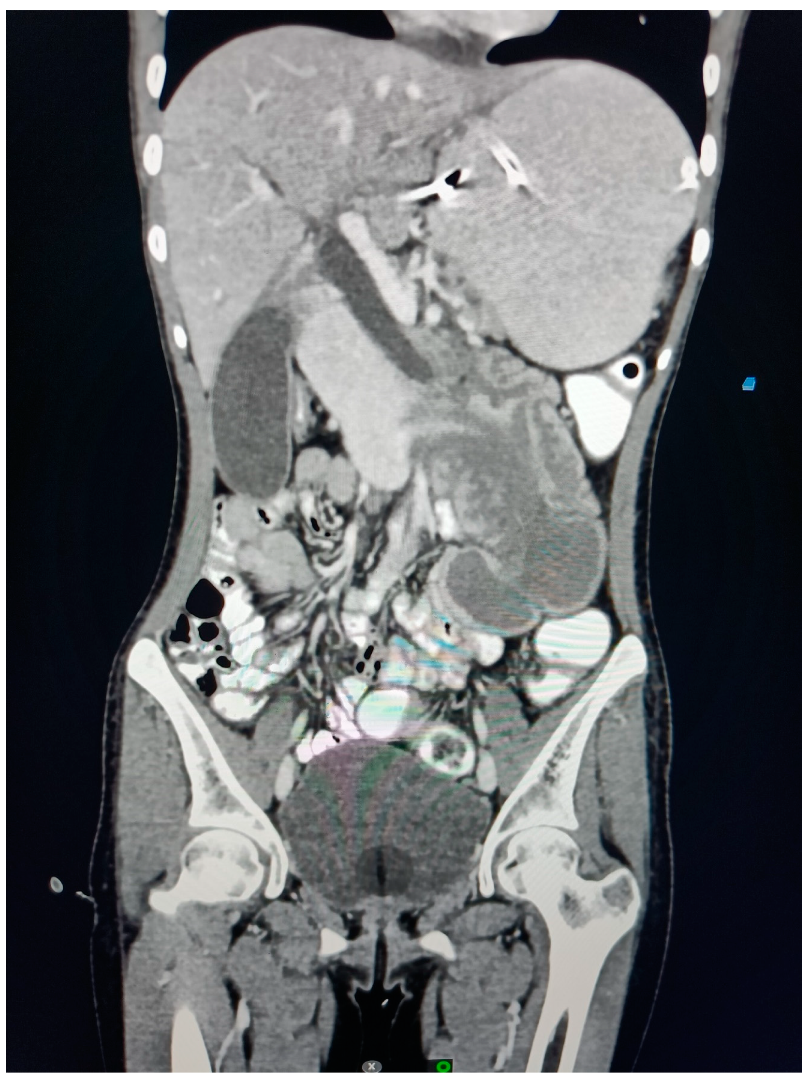 Preprints 89586 g004