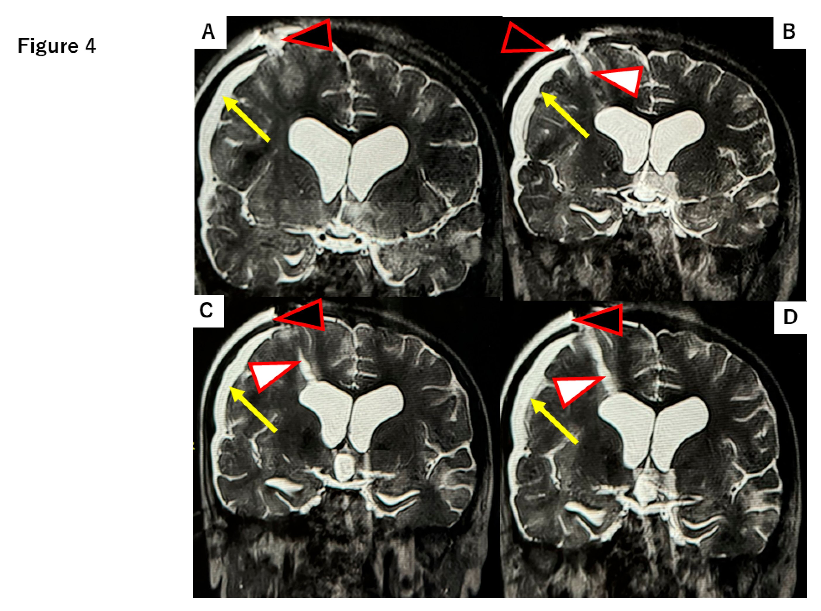 Preprints 169880 g004