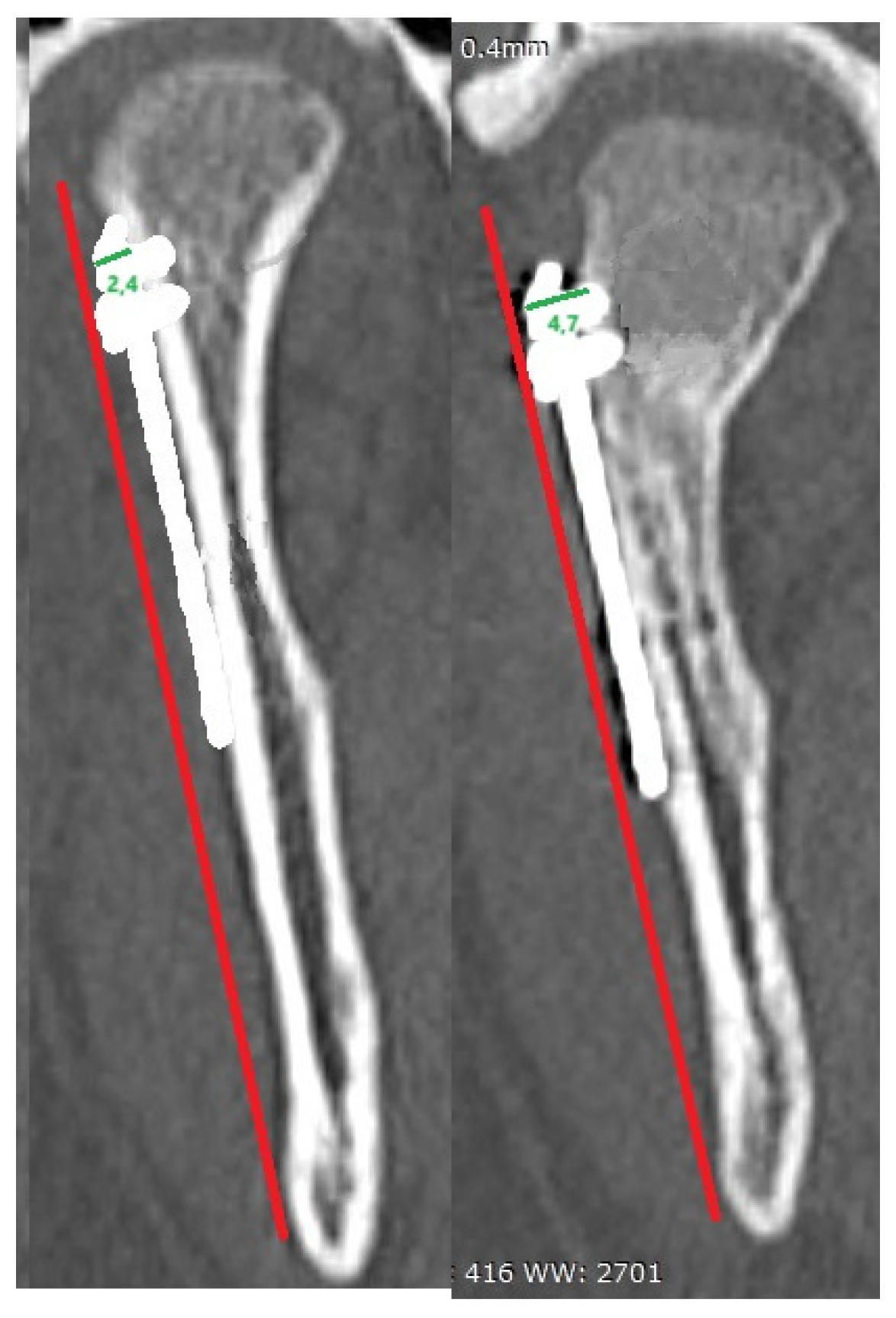 Preprints 160335 i001